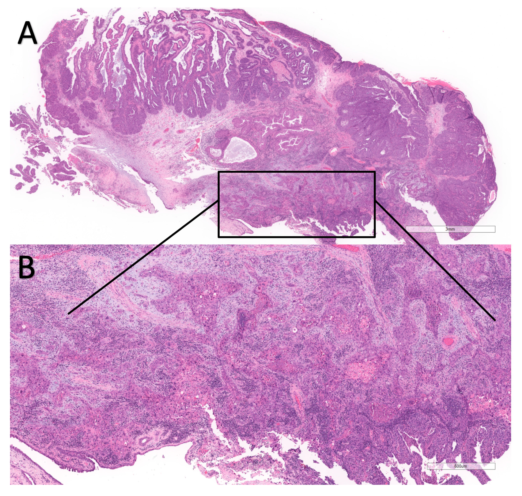 Cancers 17 01798 g001