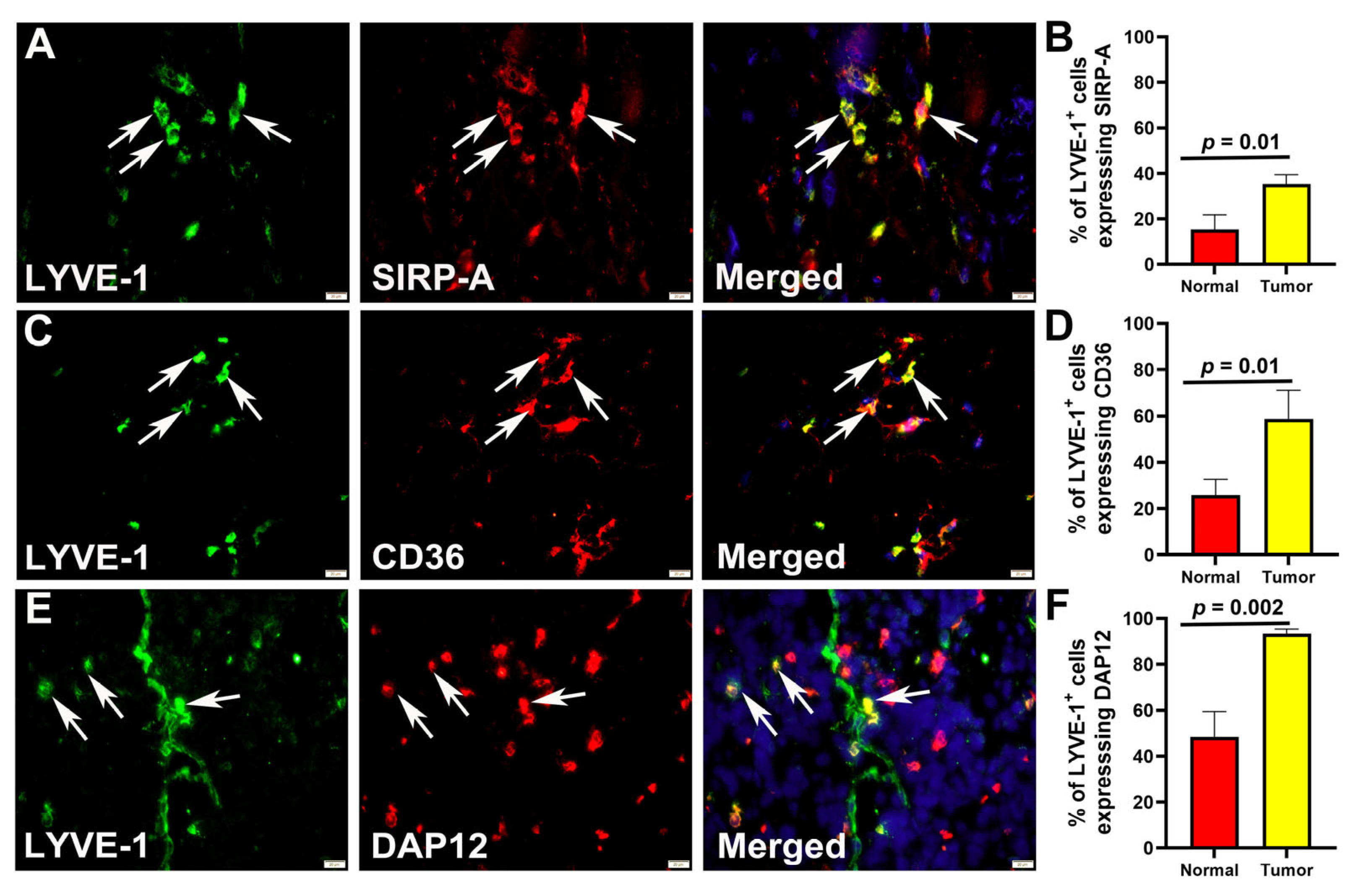 Cancers 17 01804 g004