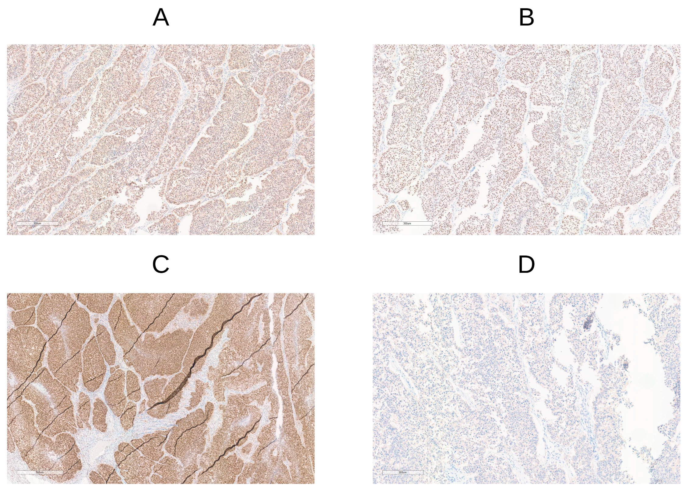 Cancers 17 01806 g002