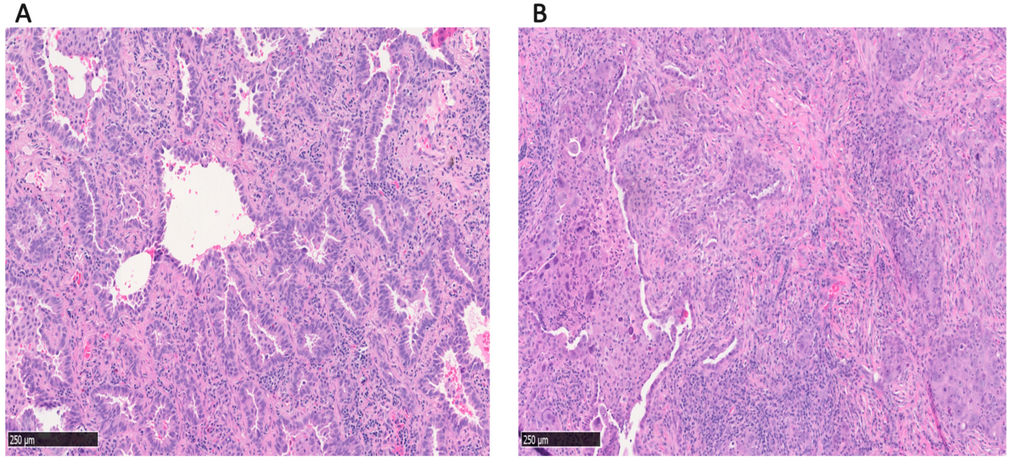 Cancers 17 01825 g001
