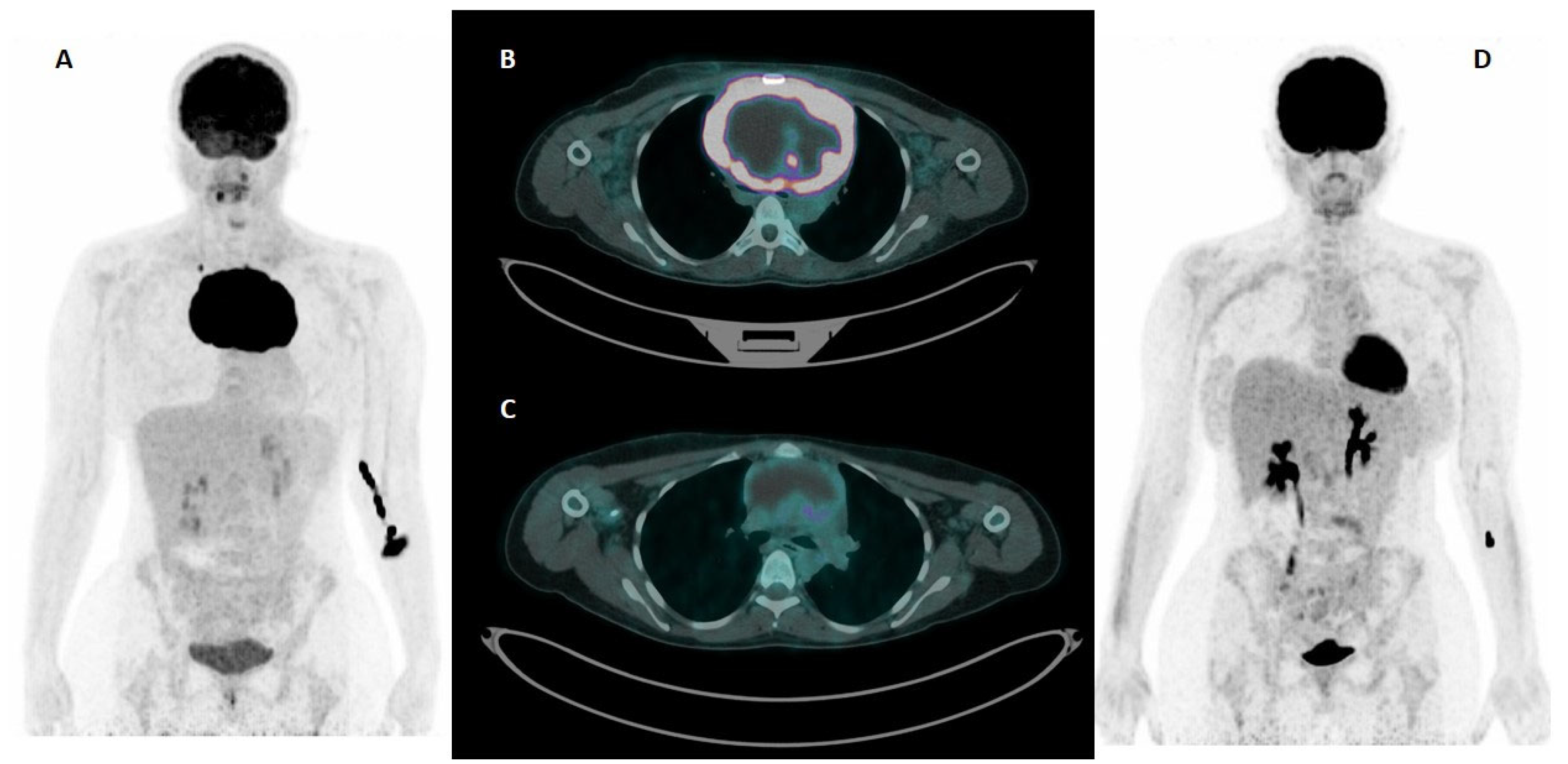 Cancers 17 01827 g002