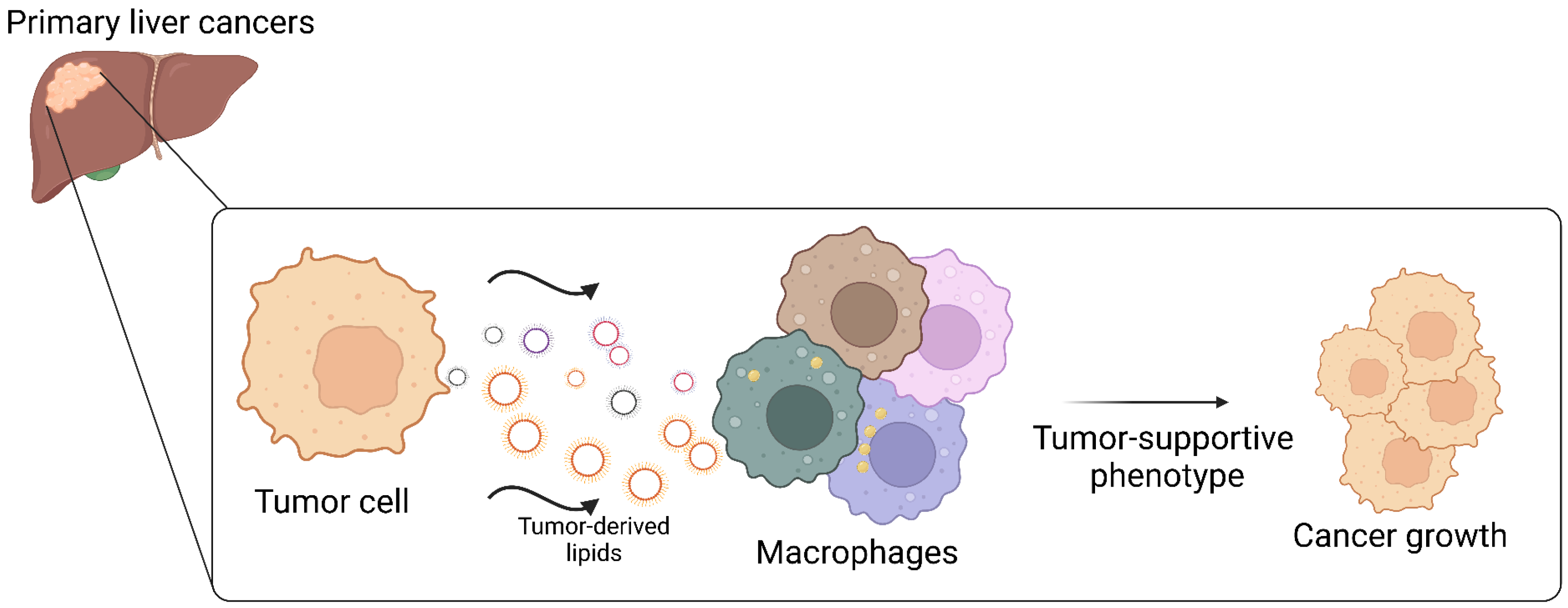 Cancers 17 01858 g002