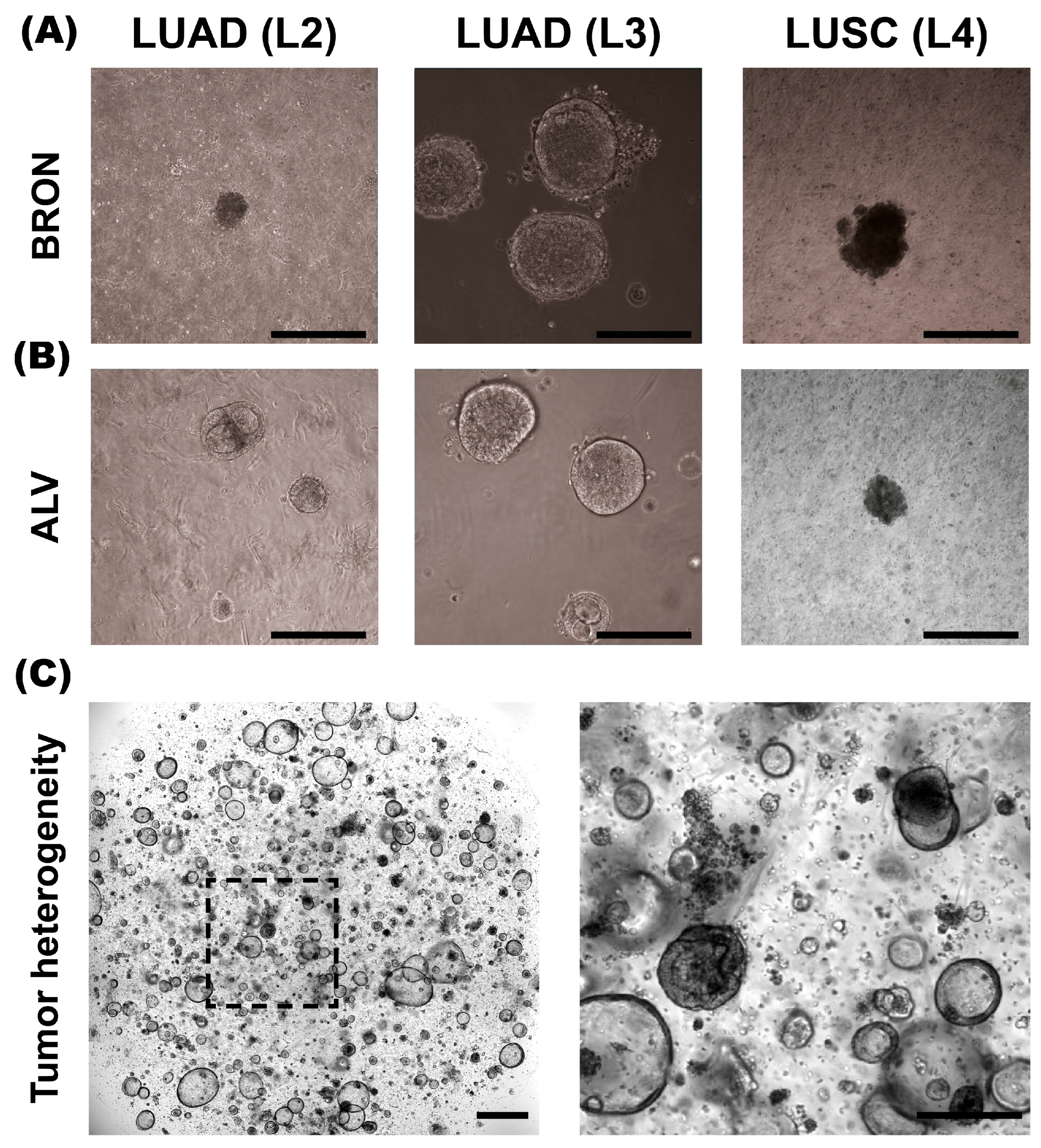 Cancers 17 01873 g001