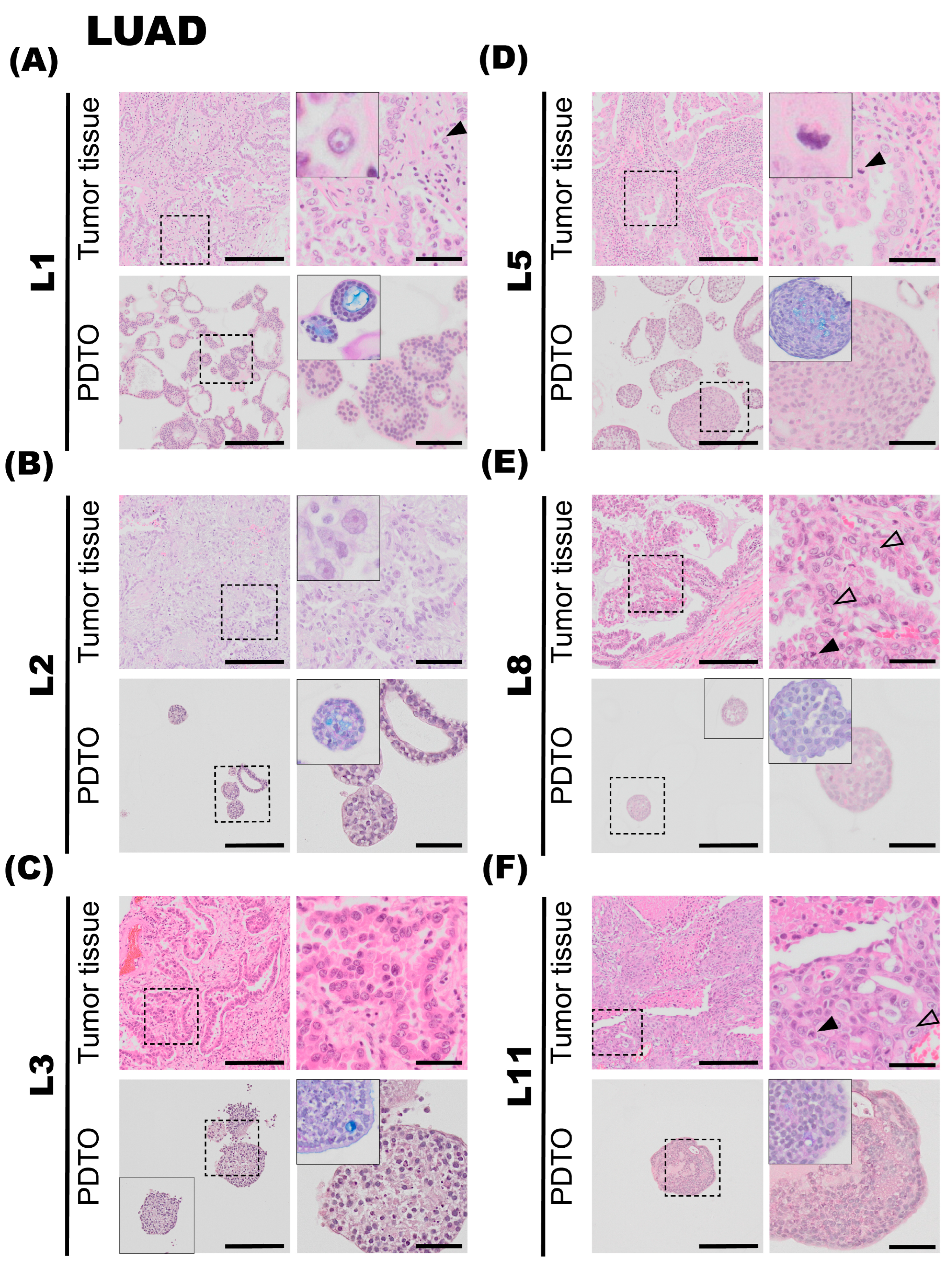 Cancers 17 01873 g002