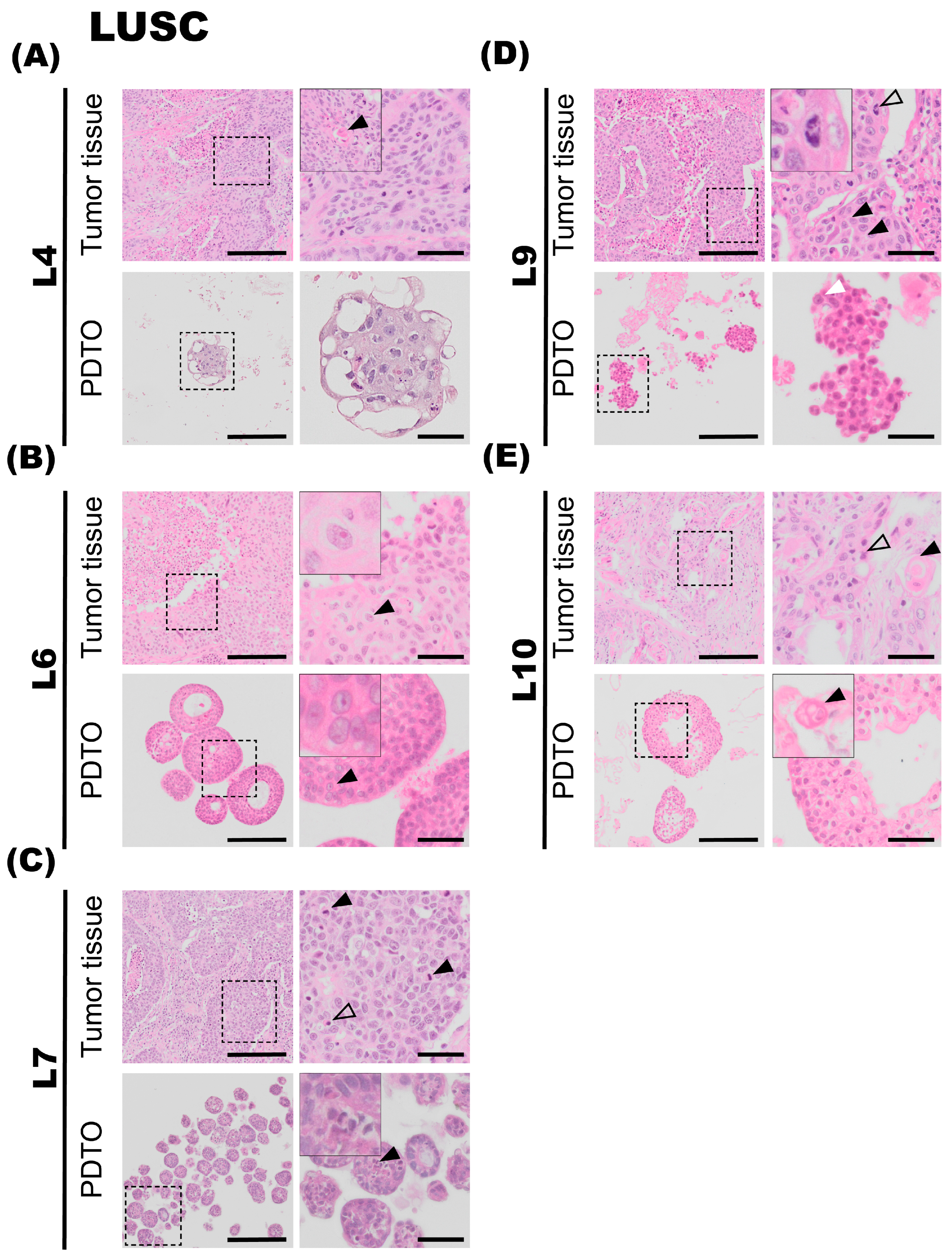 Cancers 17 01873 g003