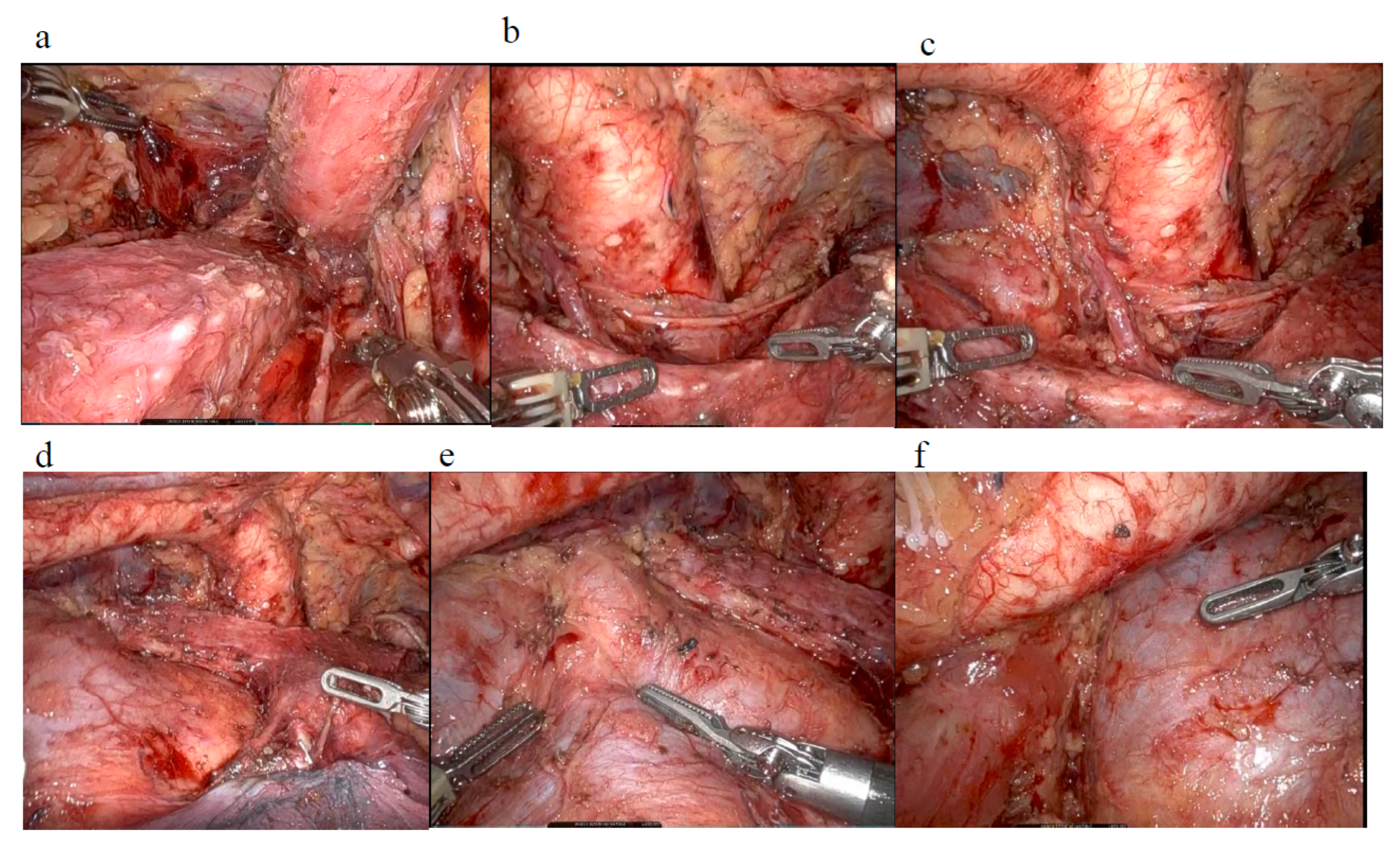Cancers 17 01878 g001 Cancers 17 01878 g001