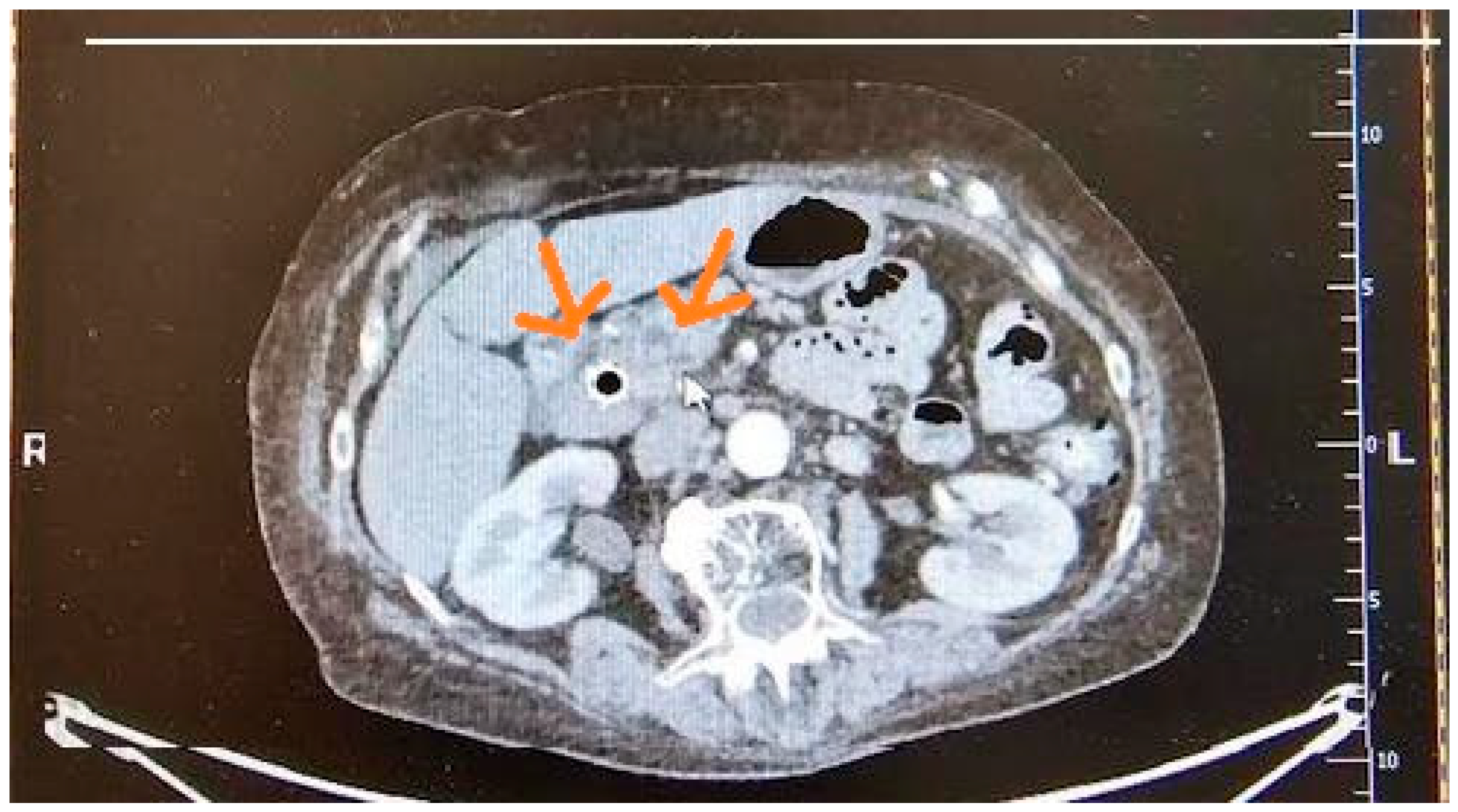 Cancers 17 01891 g002