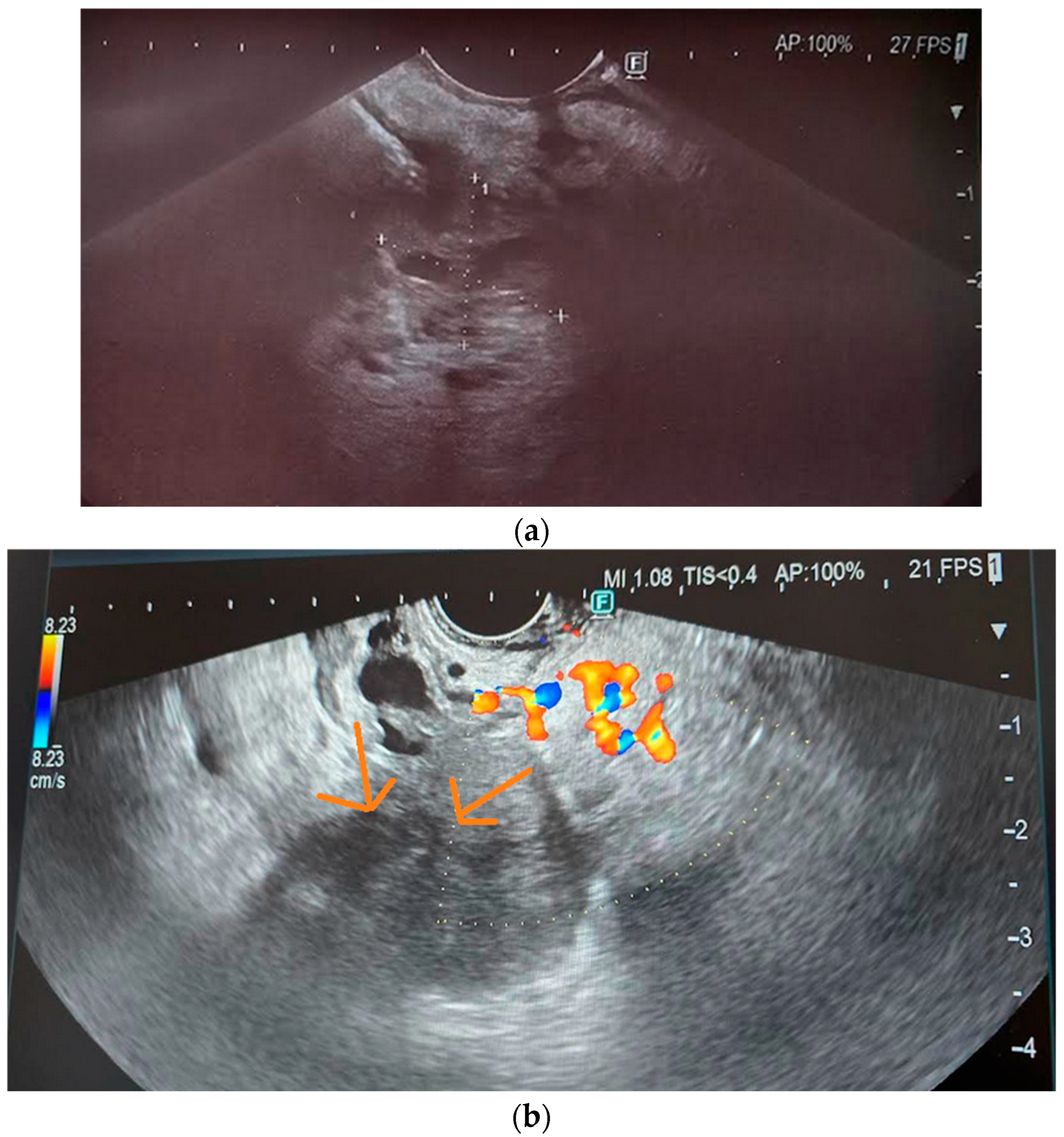 Cancers 17 01891 g003