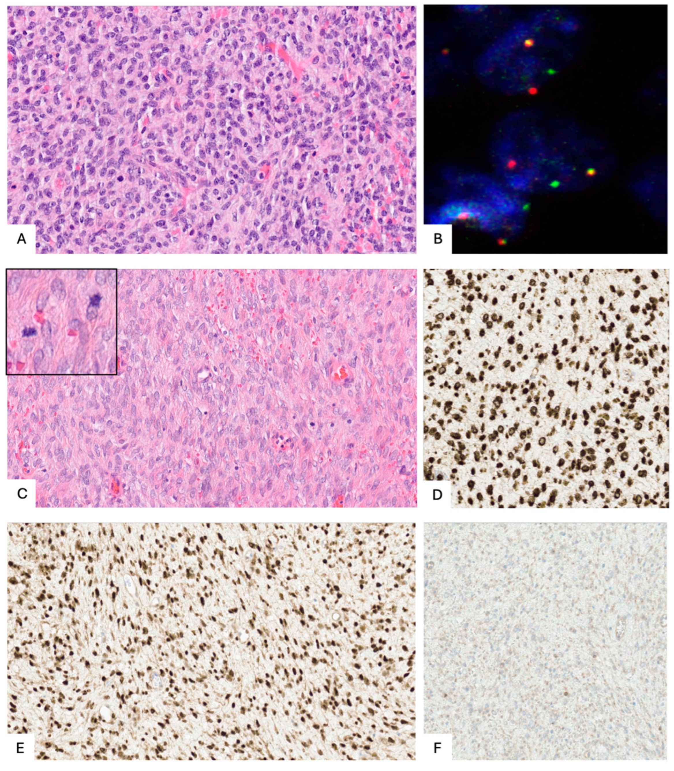 Cancers 17 01893 g002