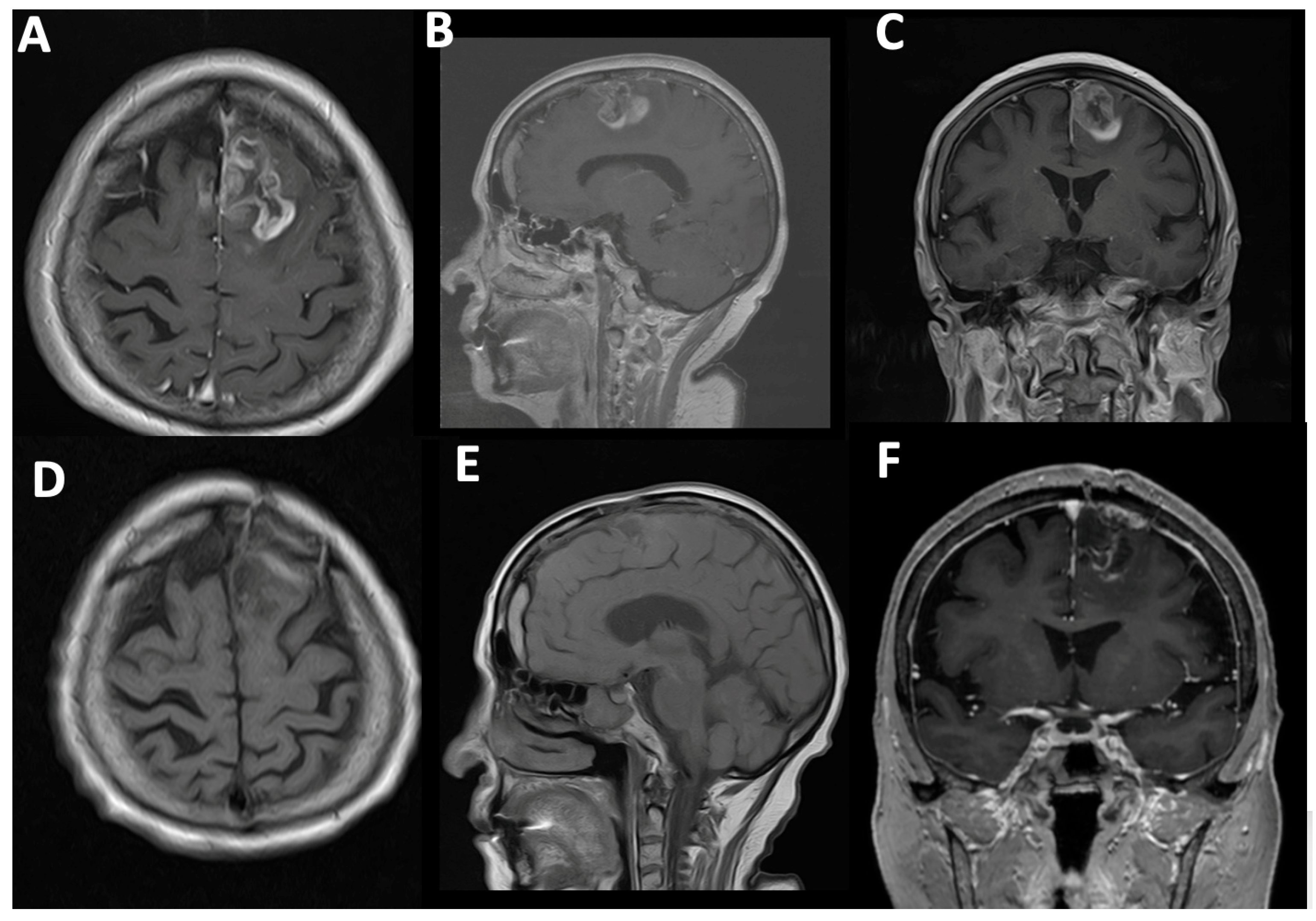 Cancers 17 01897 g004