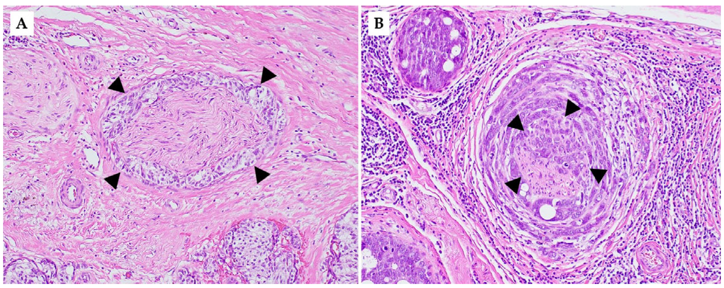 Cancers 17 01900 g002