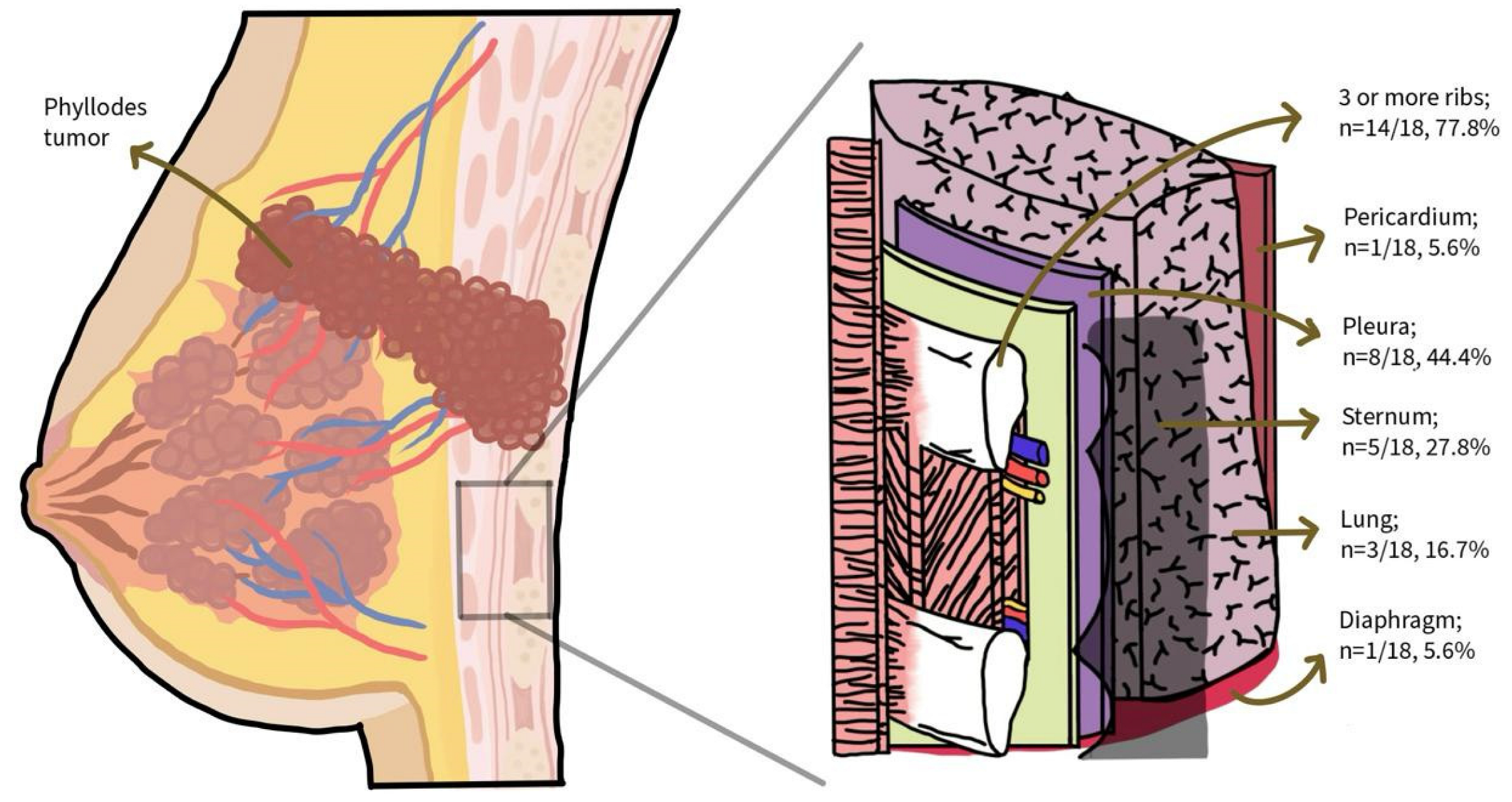 Cancers 17 01907 g002