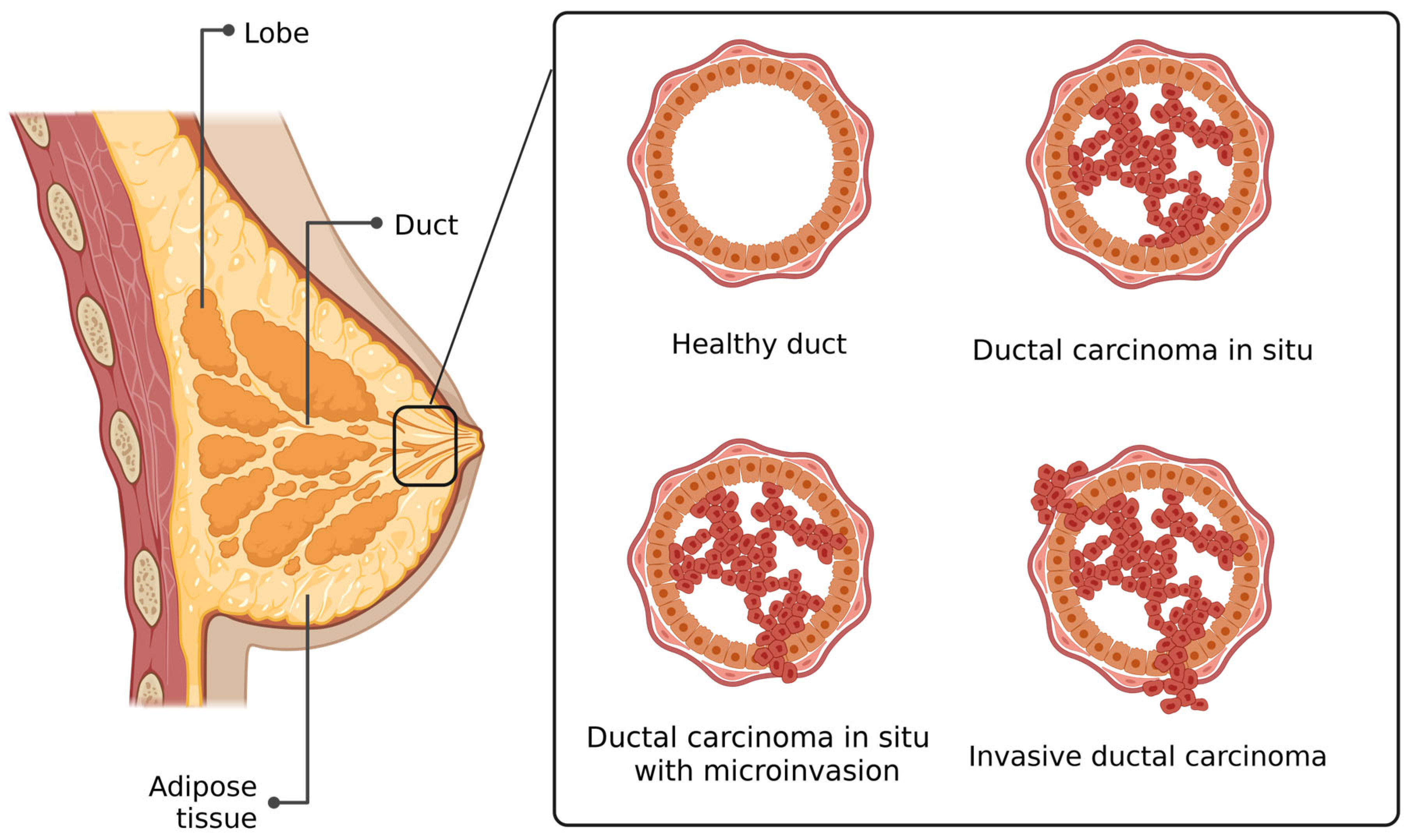 Cancers 17 01925 g001