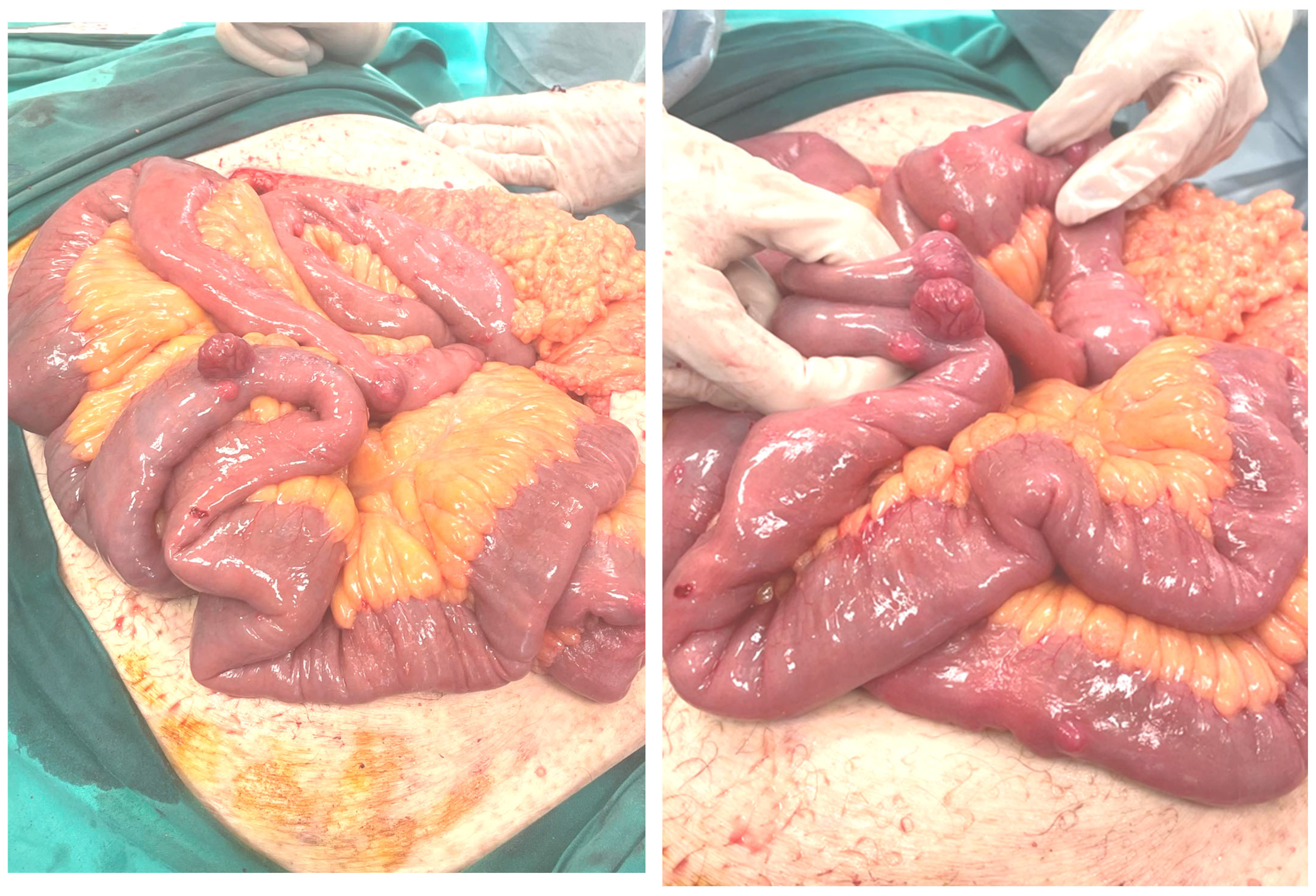 Cancers 17 01934 g004