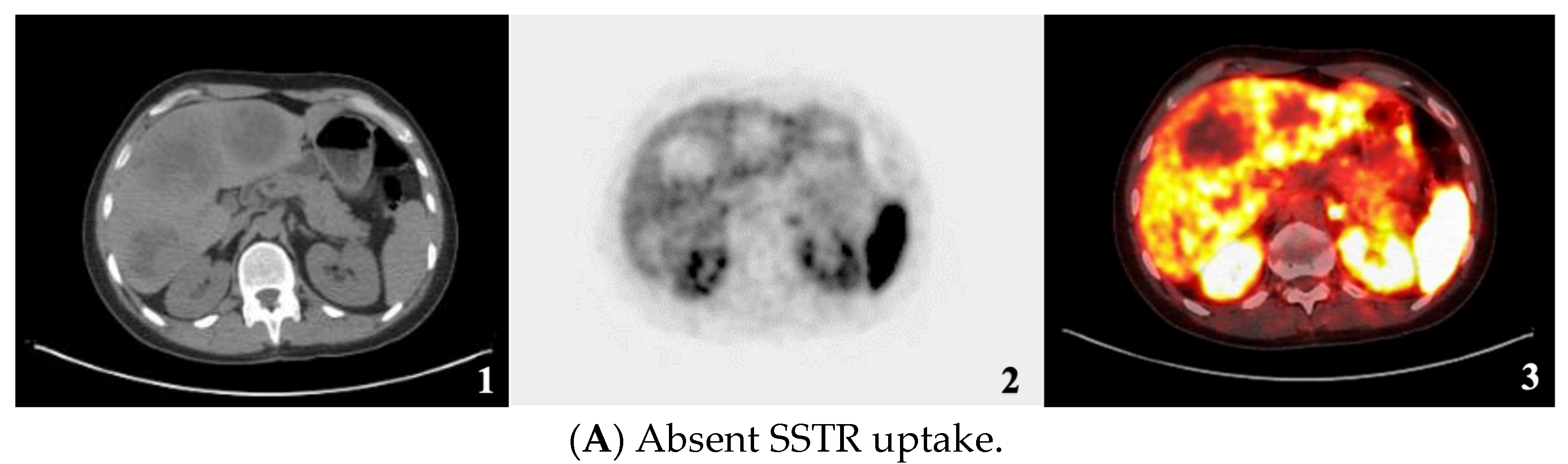 Cancers 17 01937 g002a