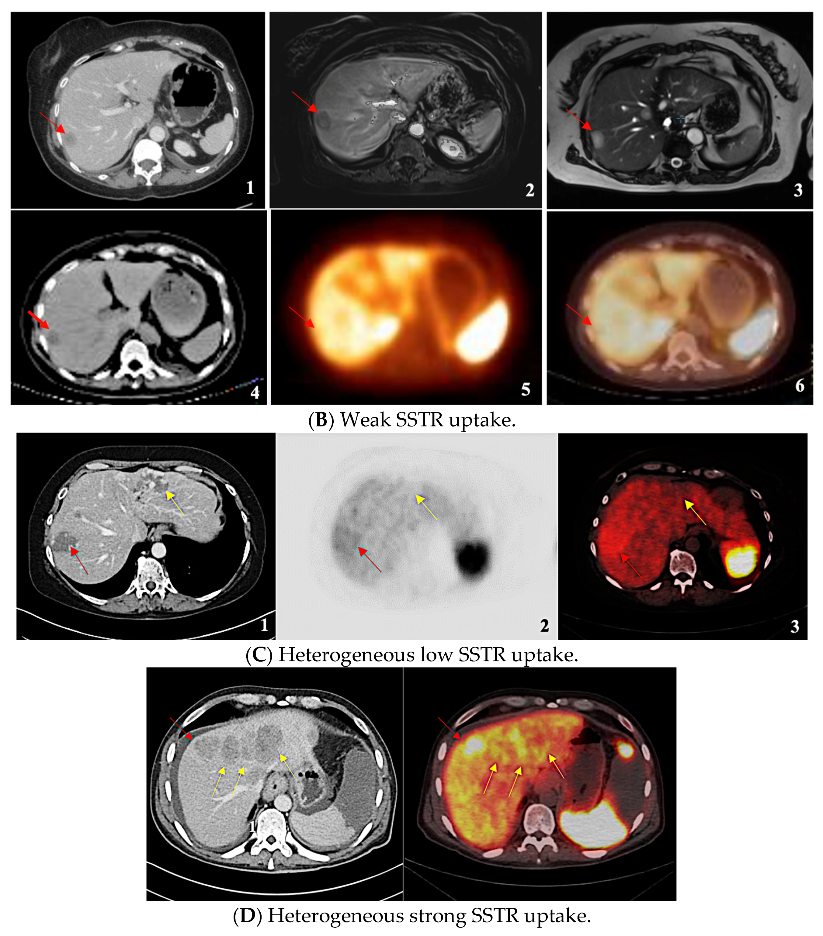 Cancers 17 01937 g002b