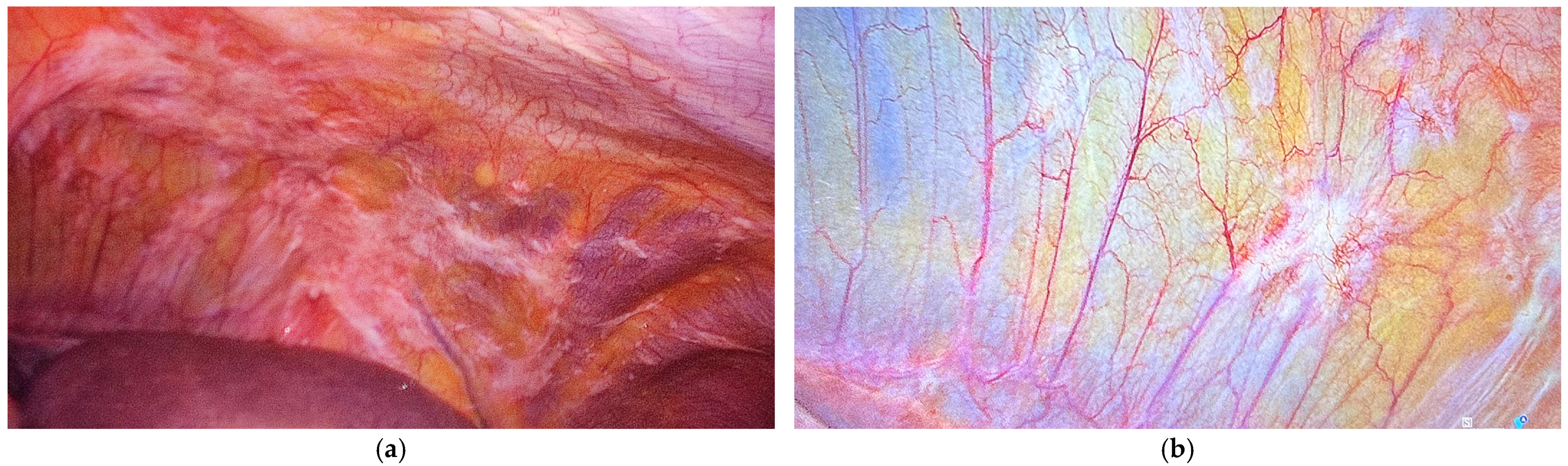 Cancers 17 01938 g002