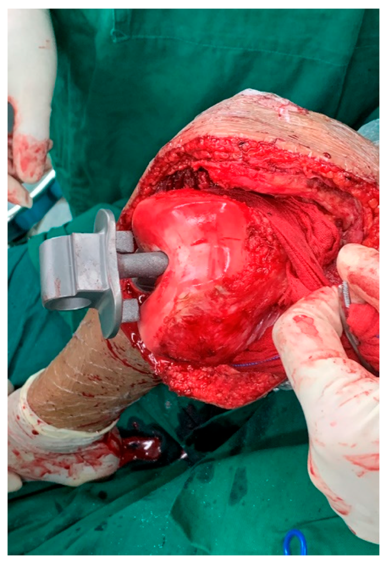 Cancers 17 01952 g002