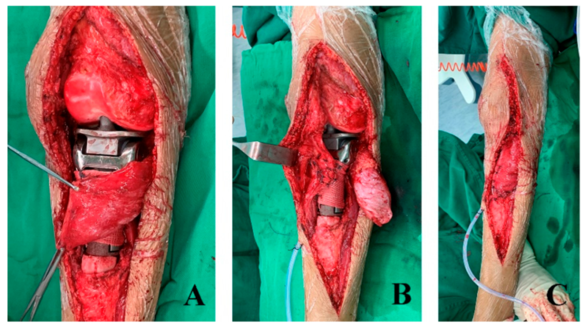 Cancers 17 01952 g003