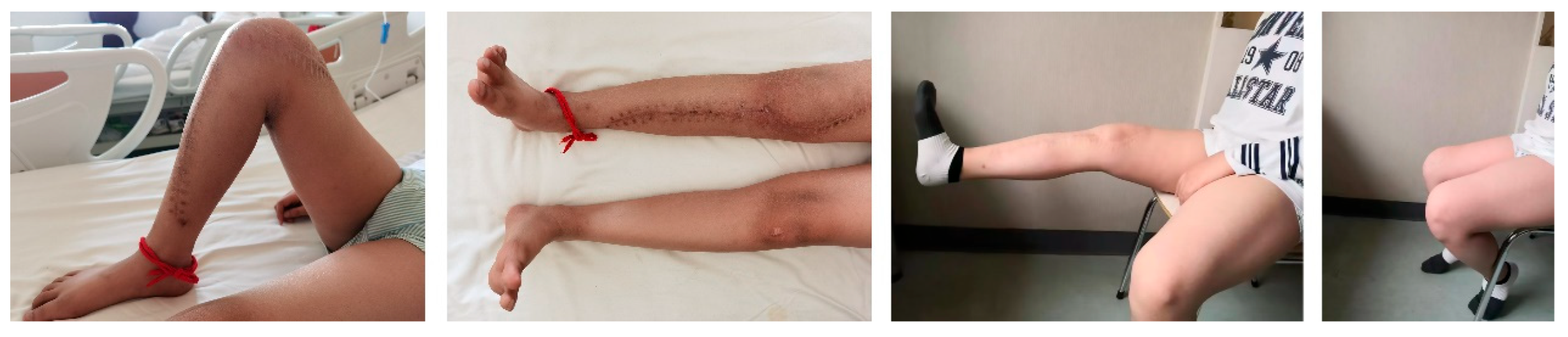 Cancers 17 01952 g004