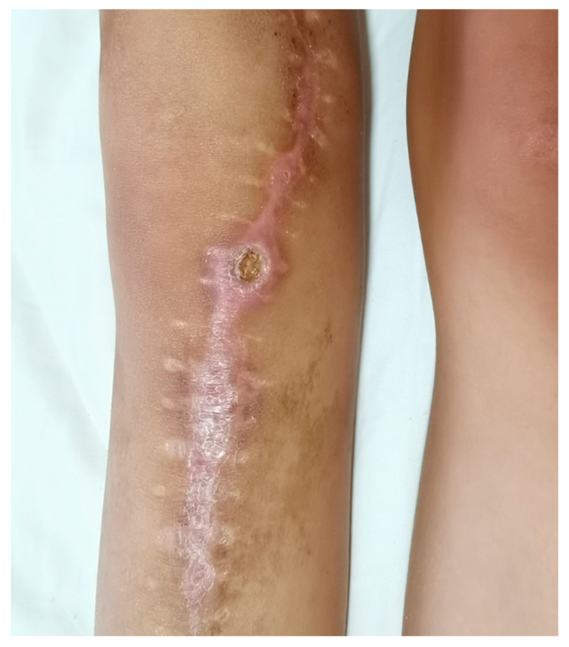 Cancers 17 01952 g005