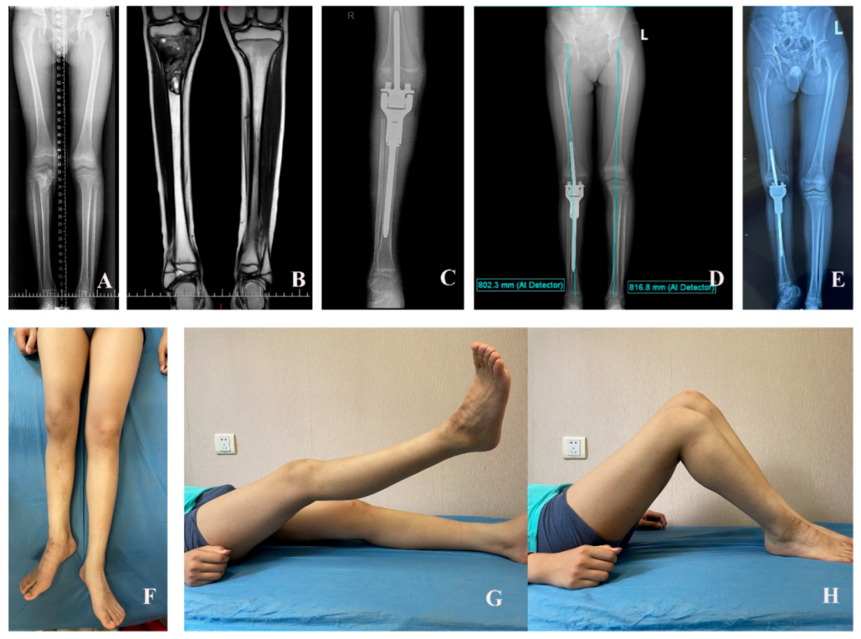 Cancers 17 01952 g006