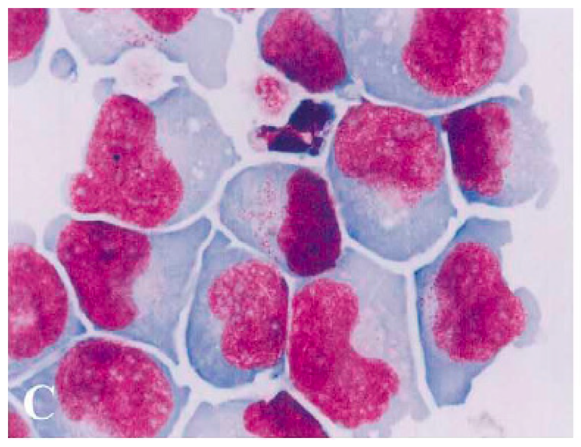 Cancers 17 01968 g001