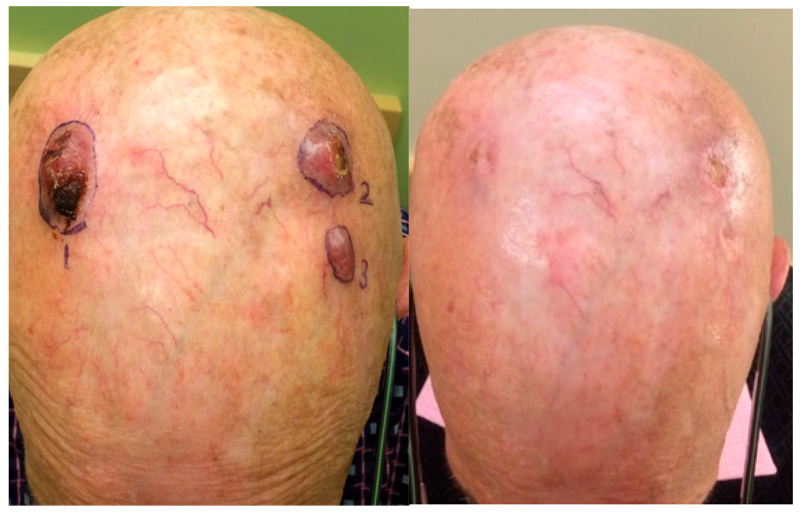 Cancers 17 01968 g002