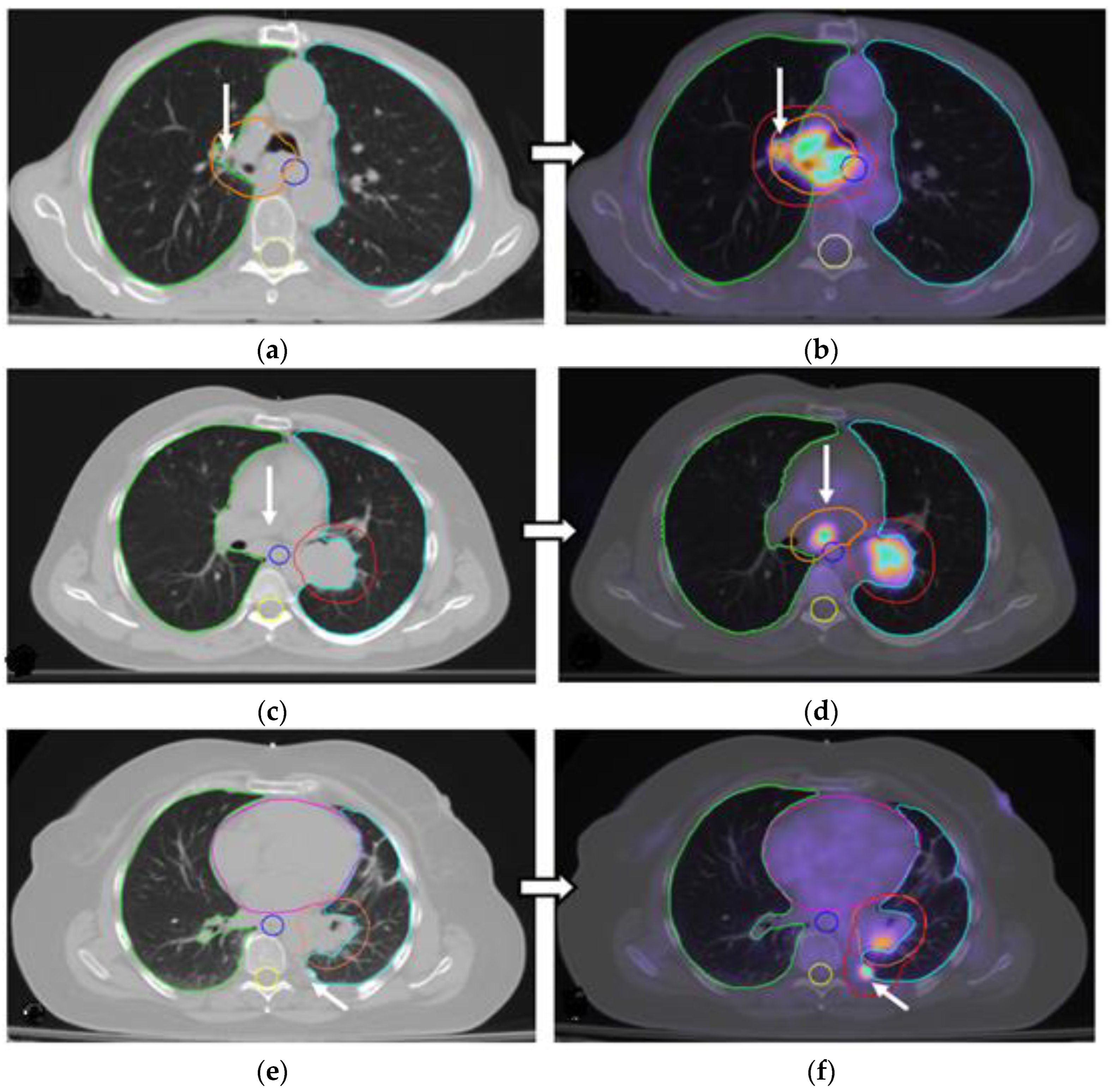 Cancers 17 01969 g002a