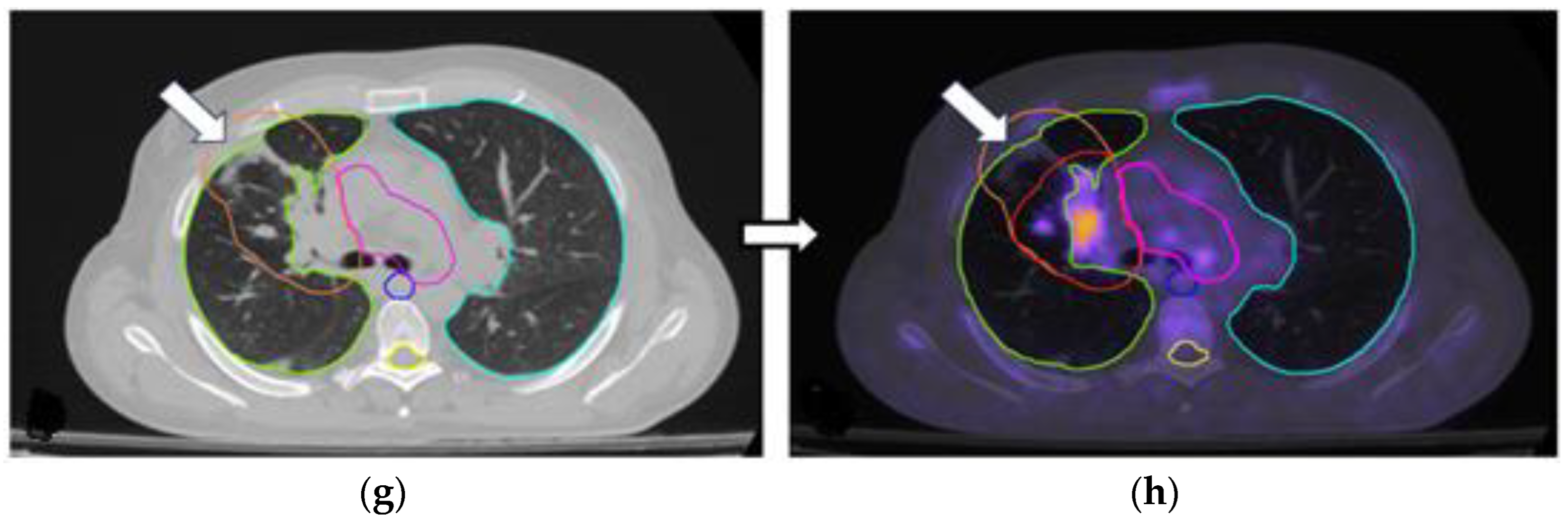 Cancers 17 01969 g002b