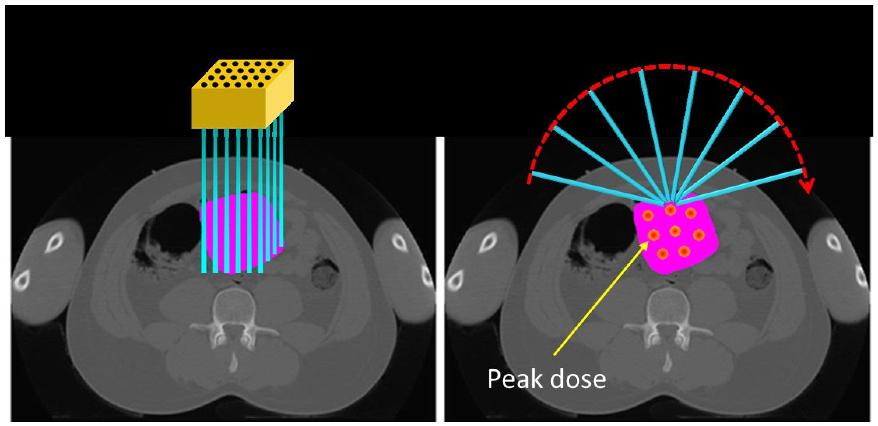 Cancers 17 01980 g005