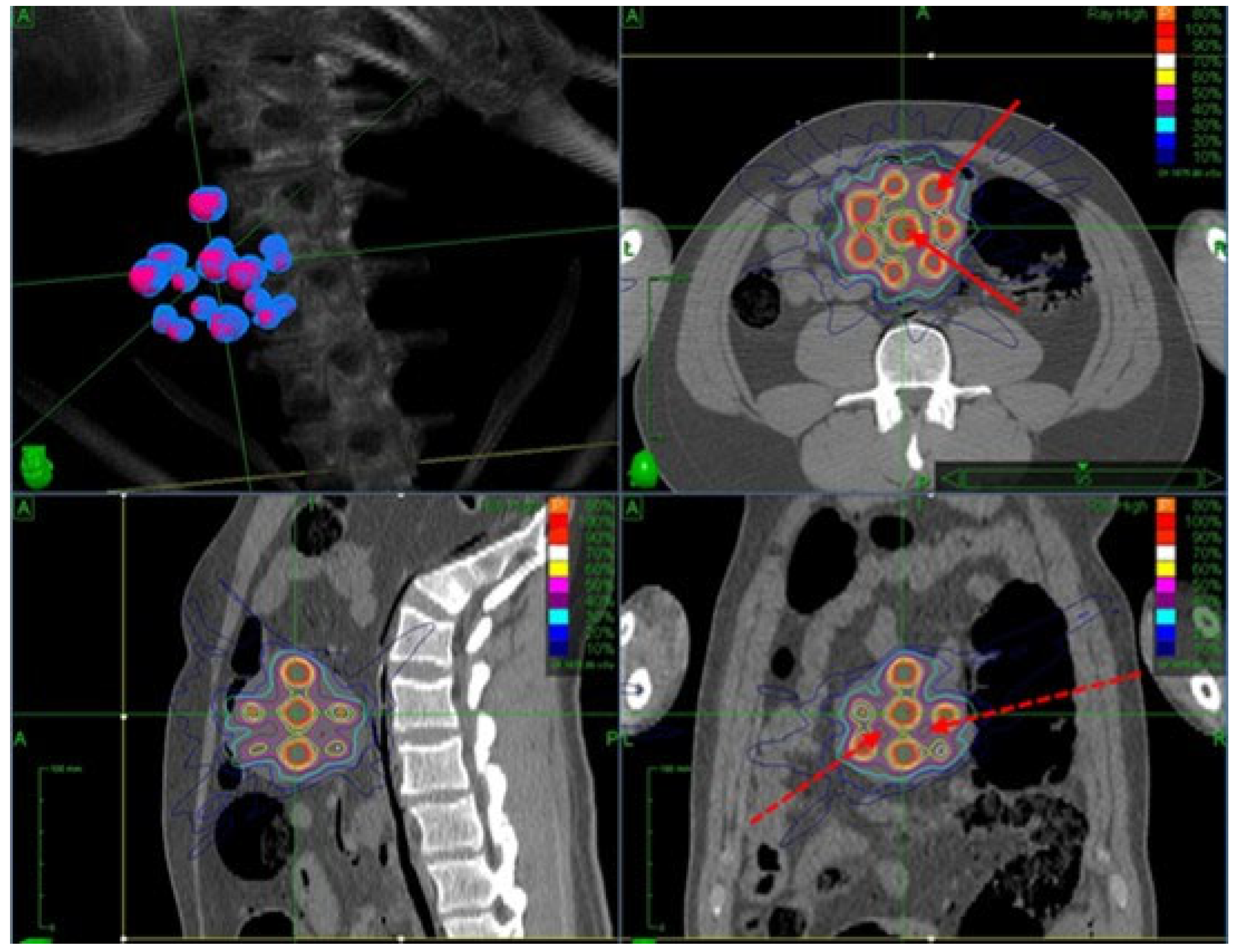 Cancers 17 01980 g006