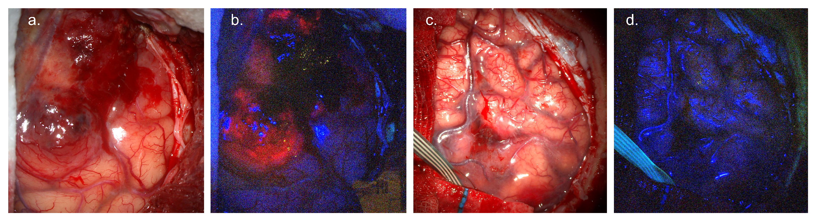 Cancers 17 02019 g001