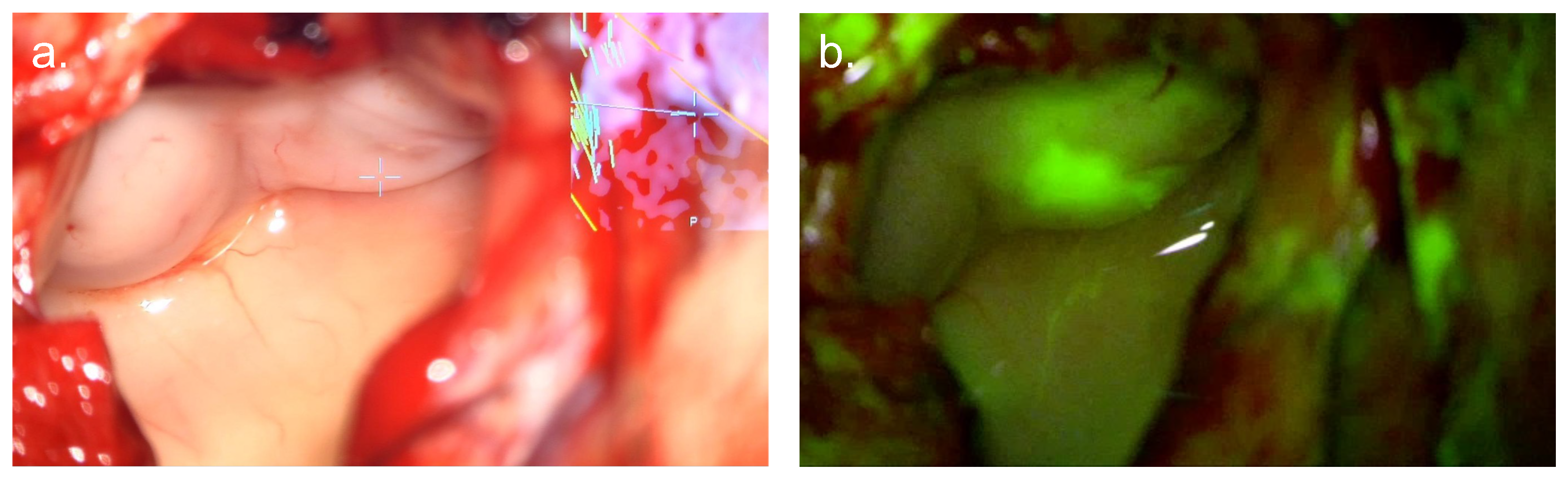 Cancers 17 02019 g003