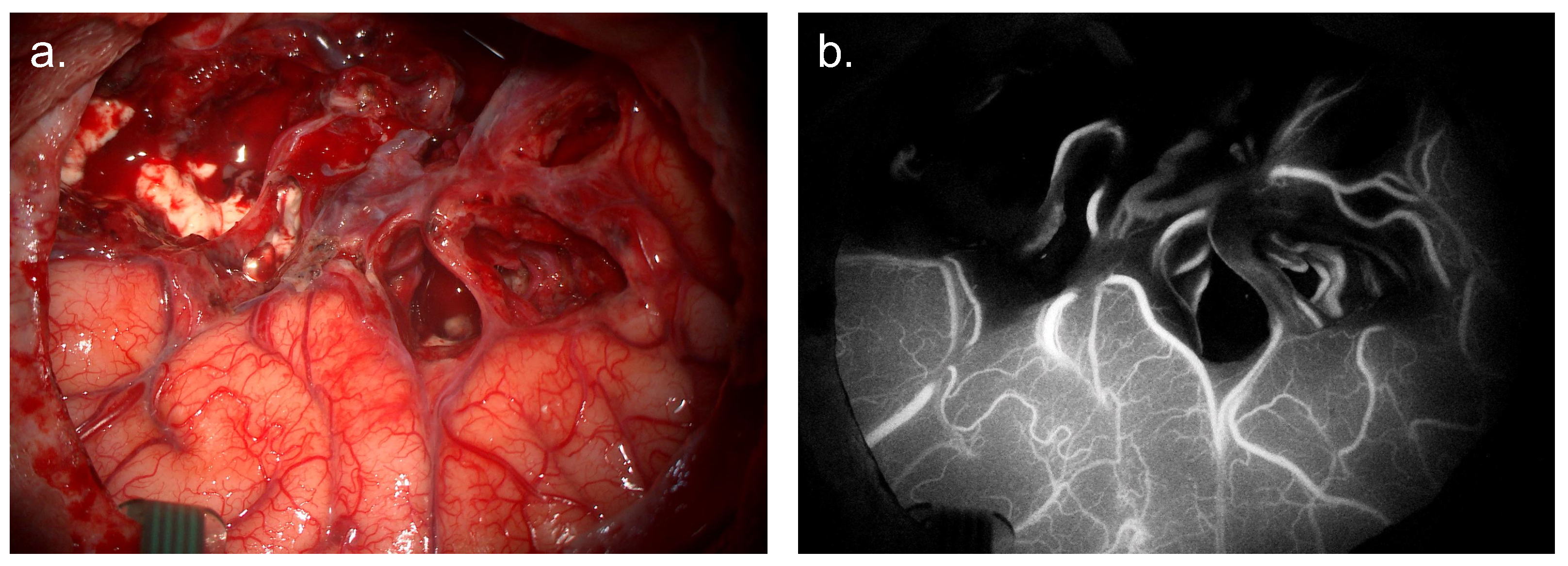 Cancers 17 02019 g004