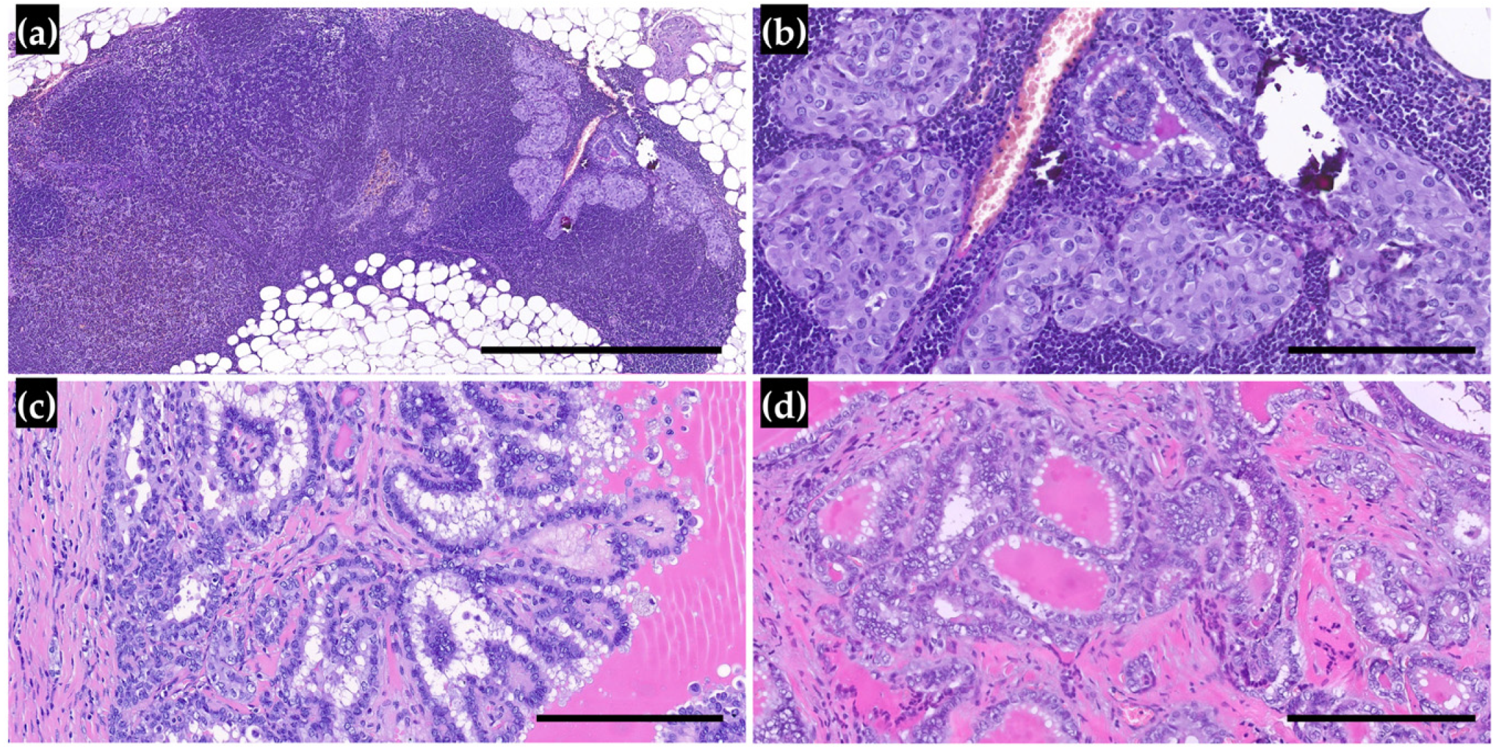 Cancers 17 02021 g003