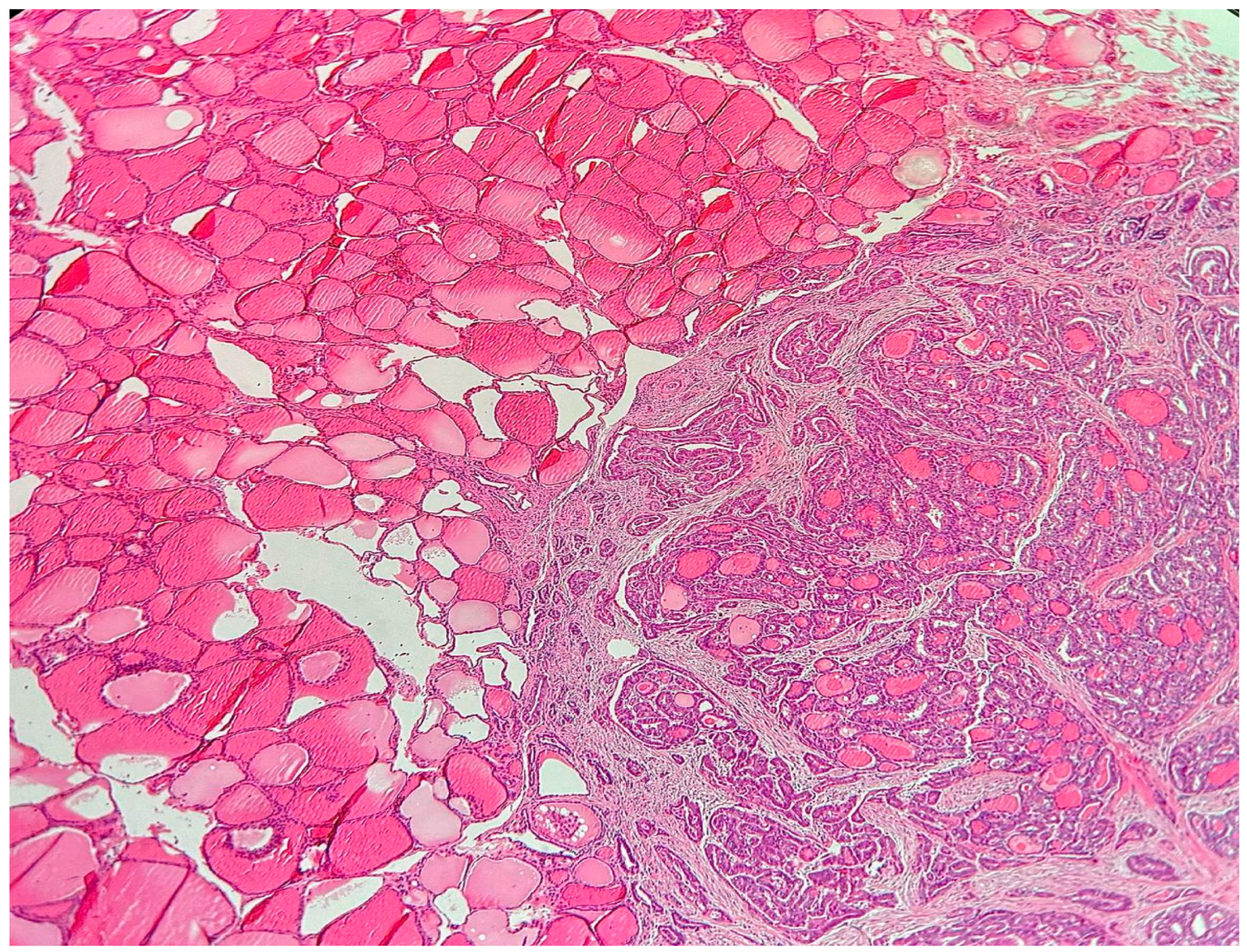 Cancers 17 02029 g001