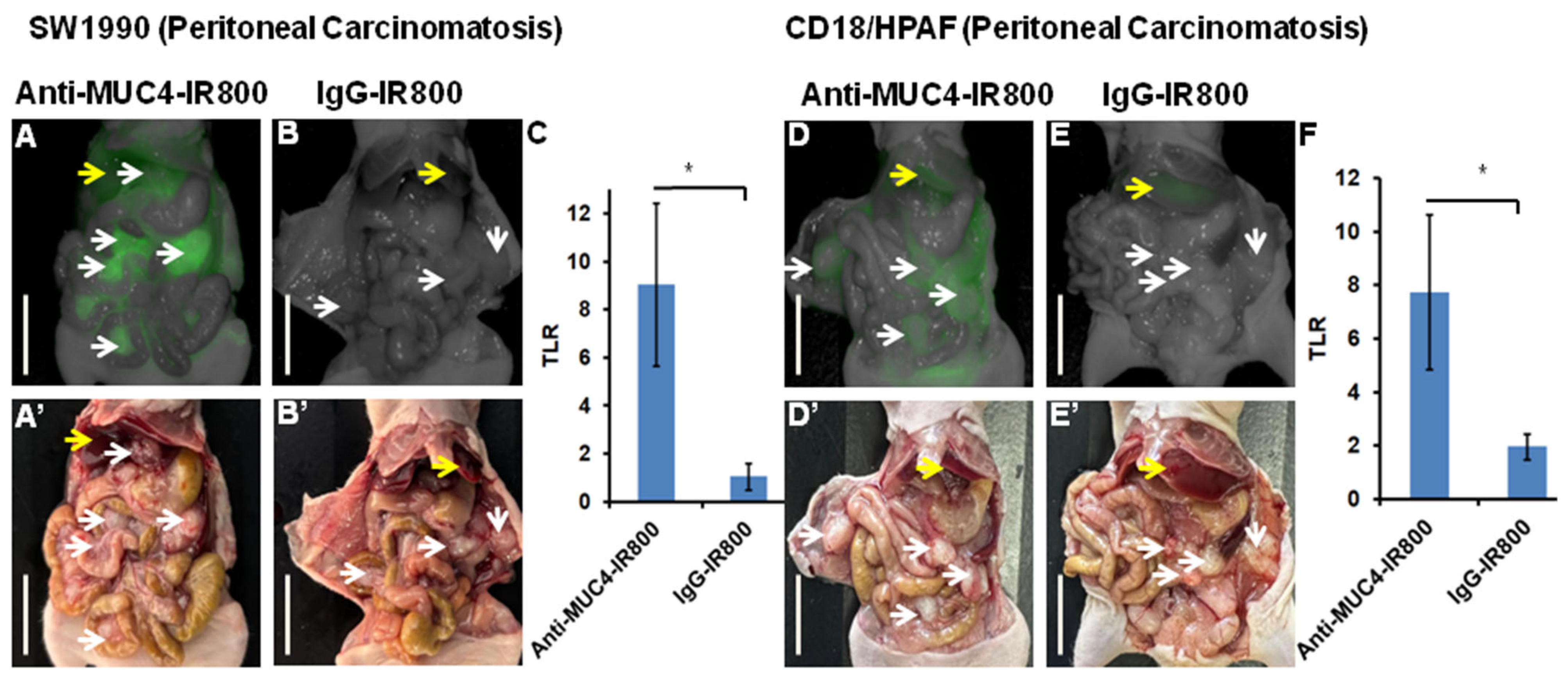 Cancers 17 02031 g002
