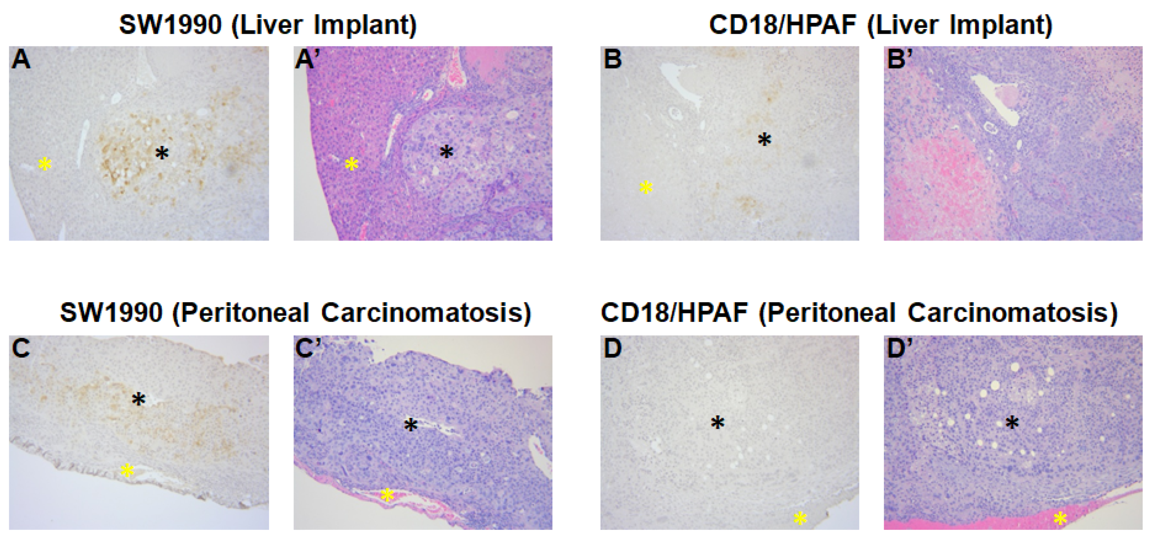 Cancers 17 02031 g004