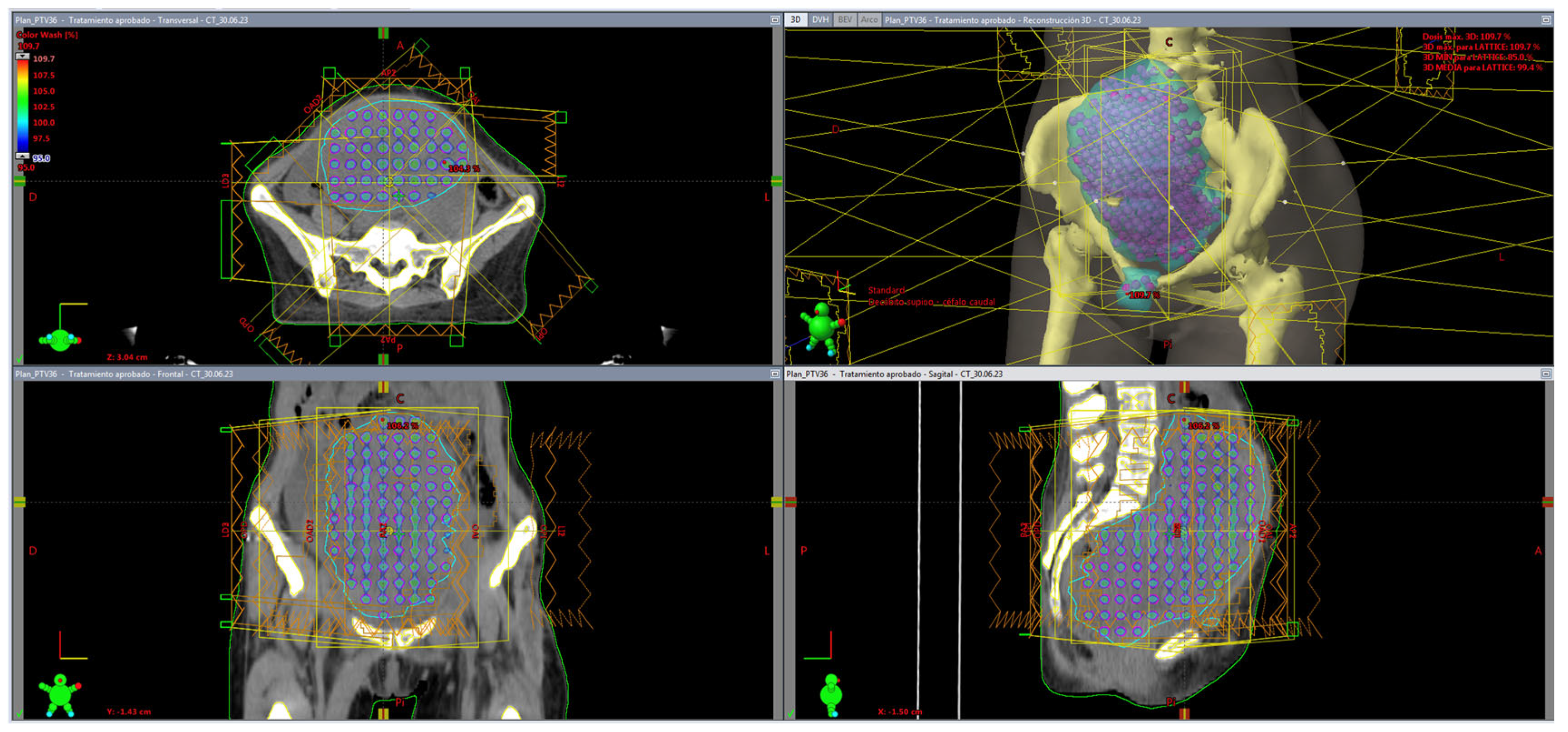 Cancers 17 02048 g002