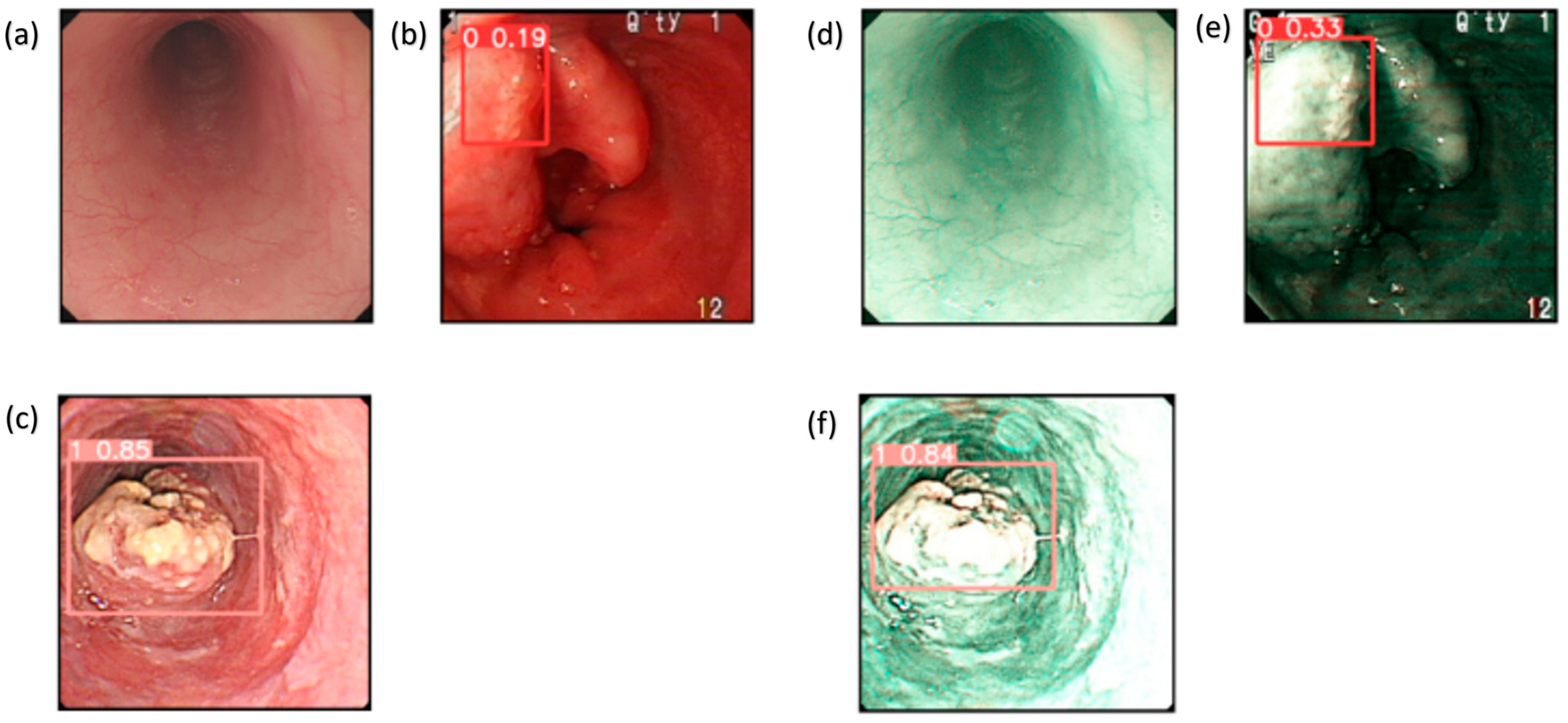 Cancers 17 02049 g004