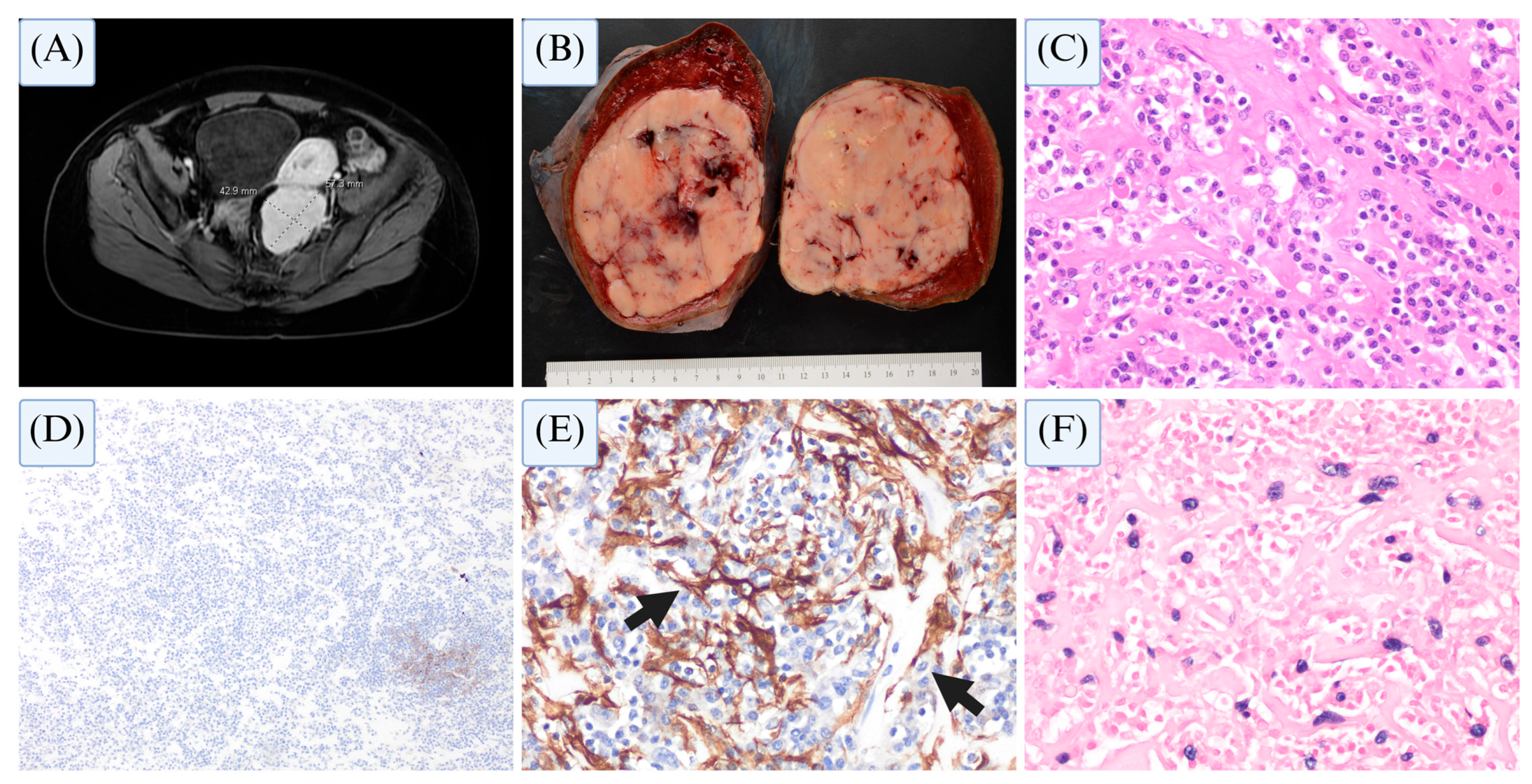 Cancers 17 02055 g007