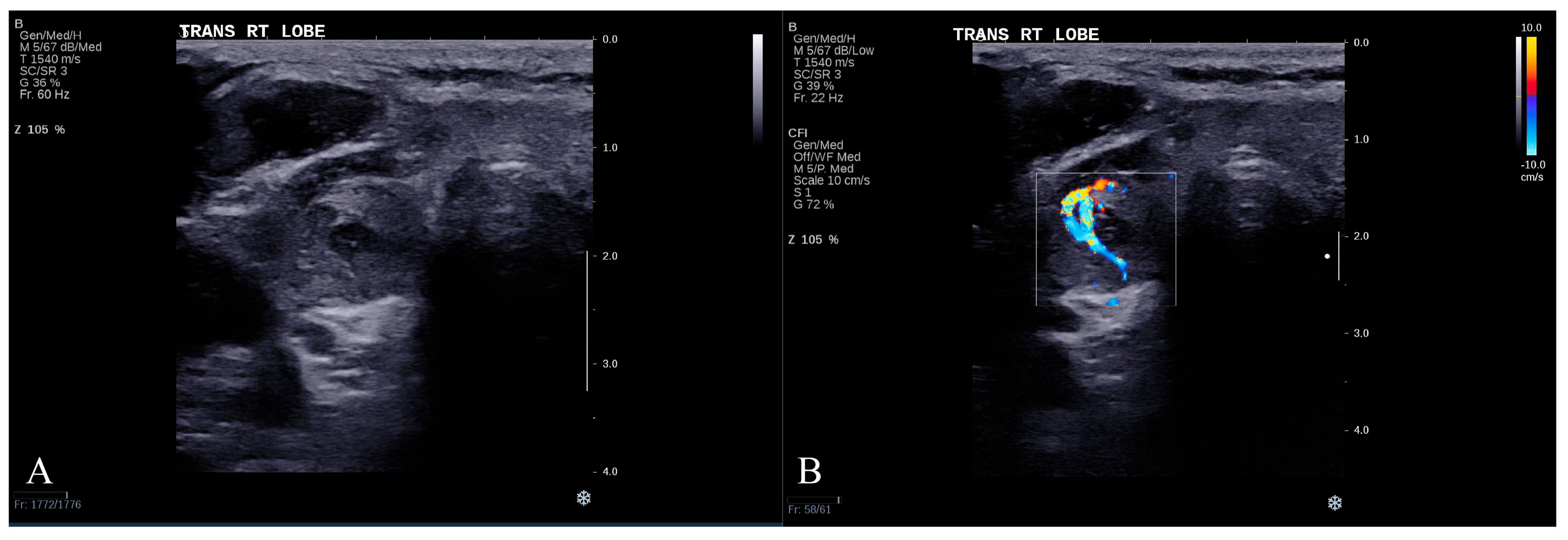 Cancers 17 02068 g005