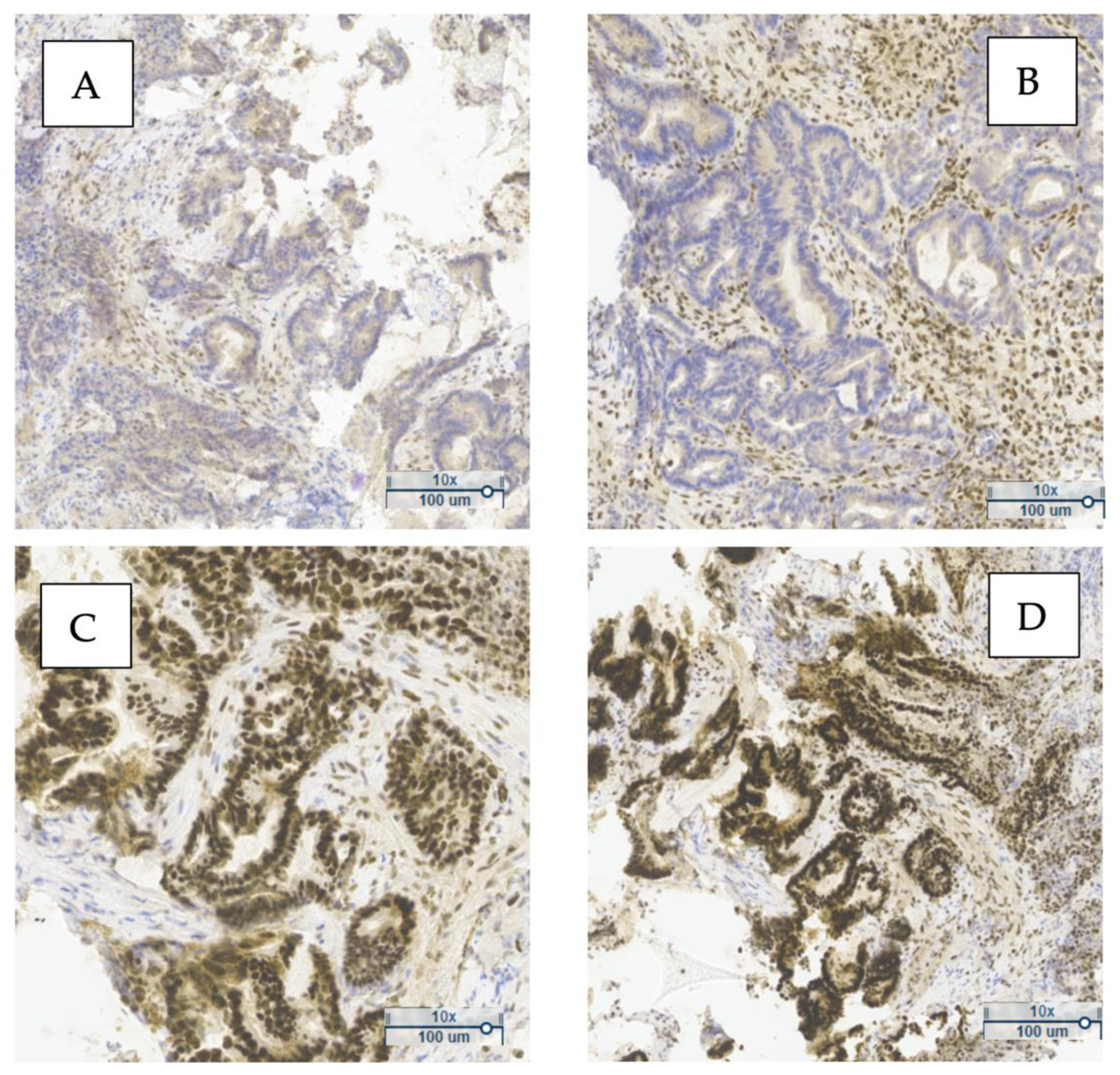 Cancers 17 02071 g001