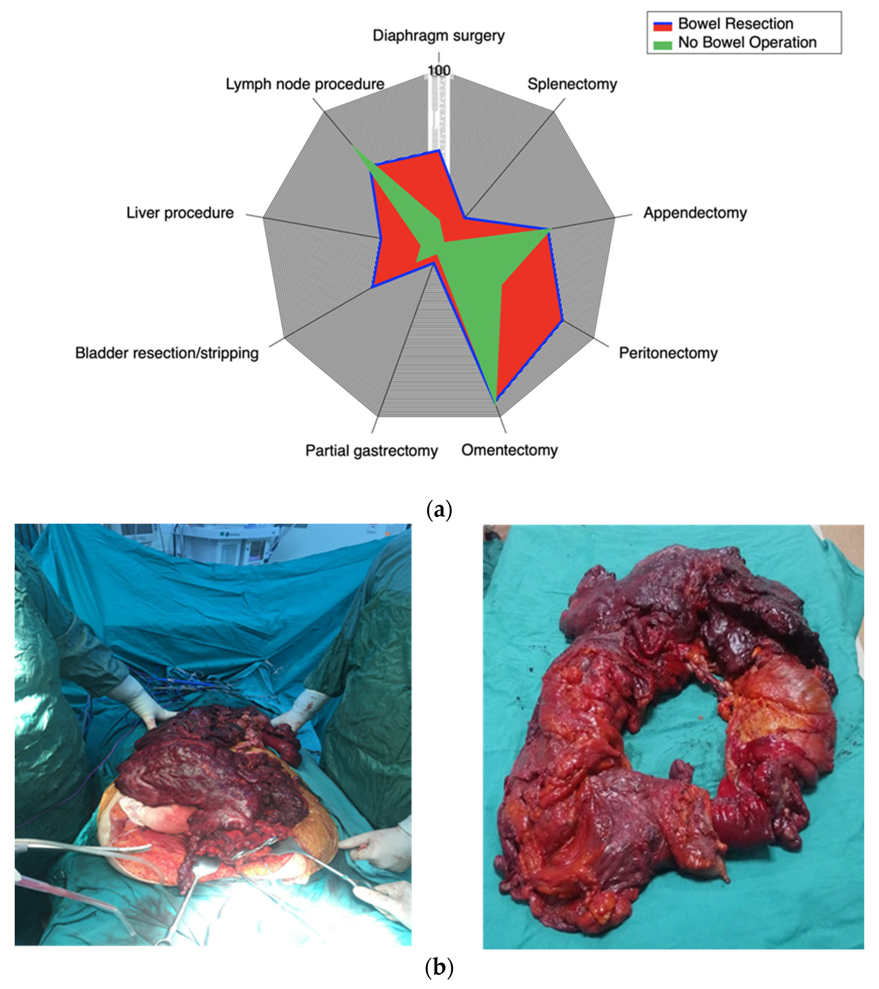 Cancers 17 02086 g001