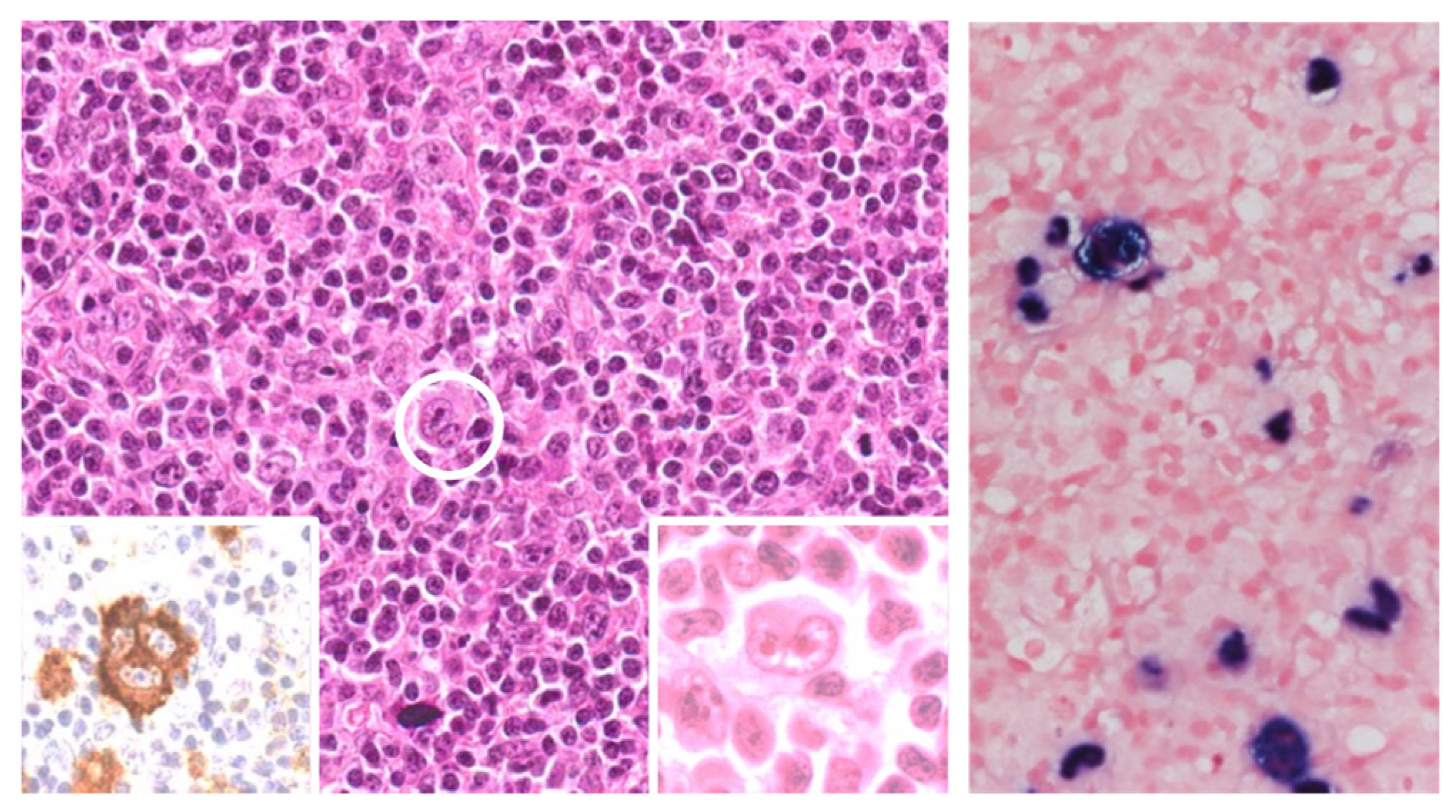 Cancers 17 02088 g001