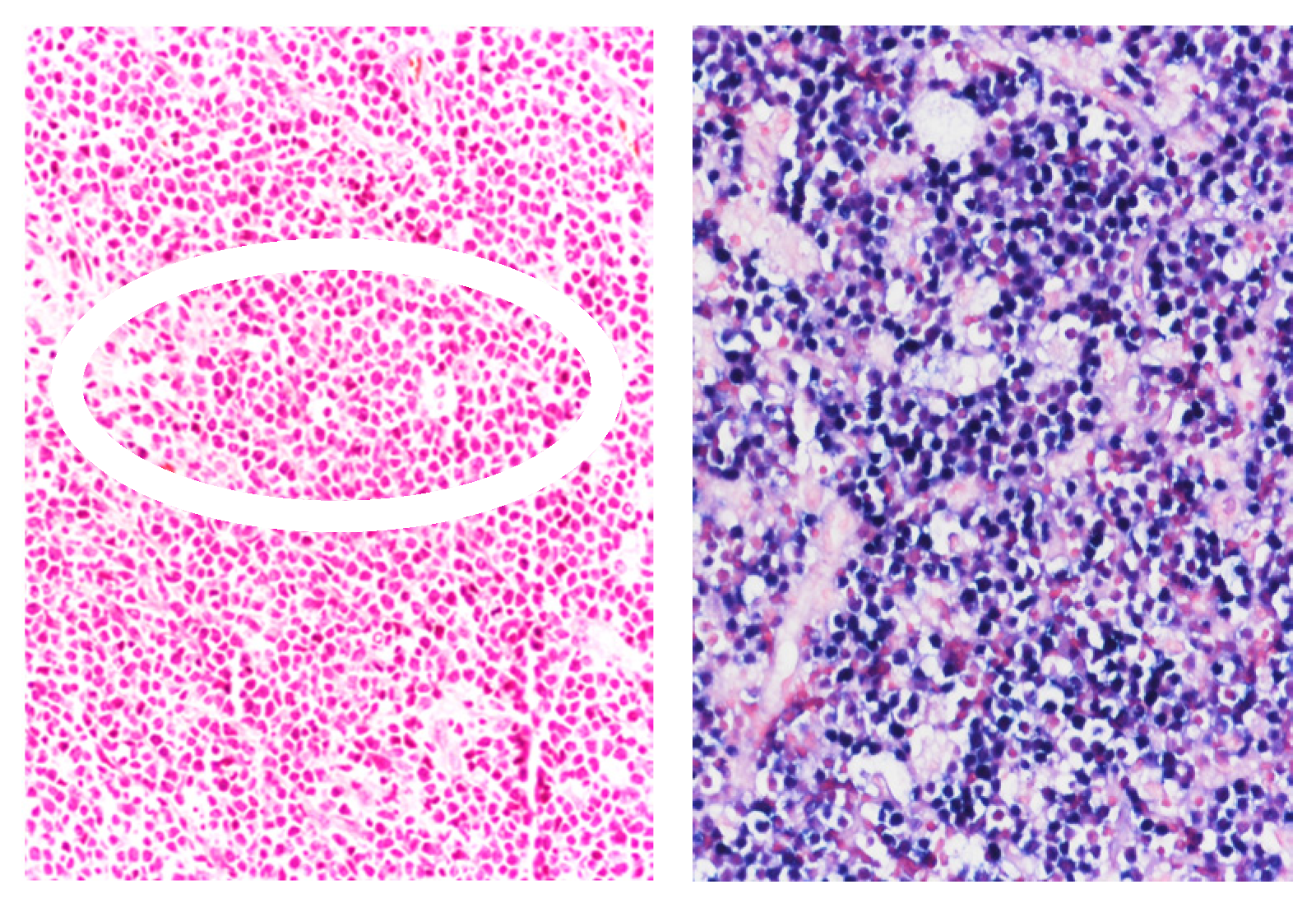 Cancers 17 02088 g002