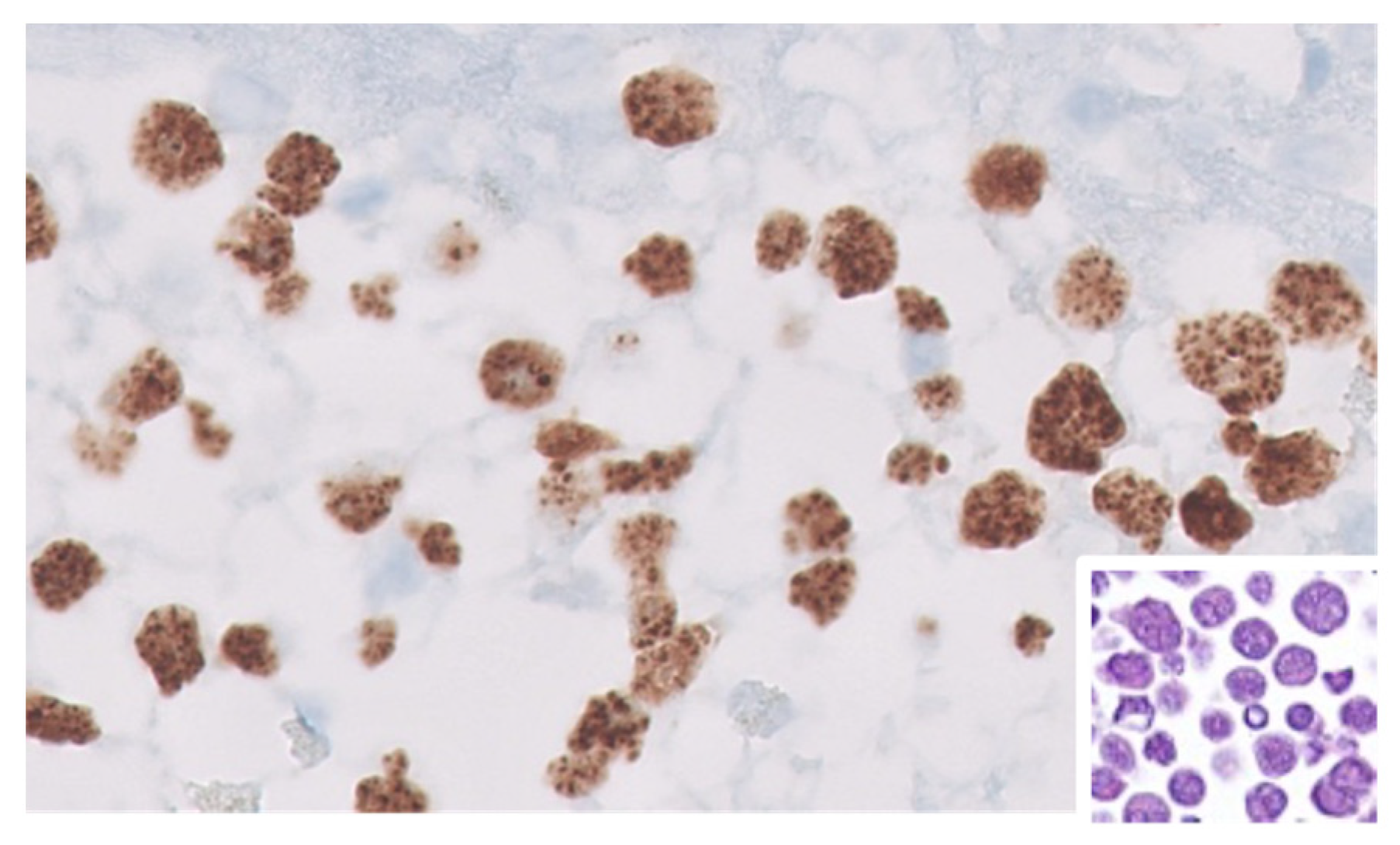 Cancers 17 02088 g003