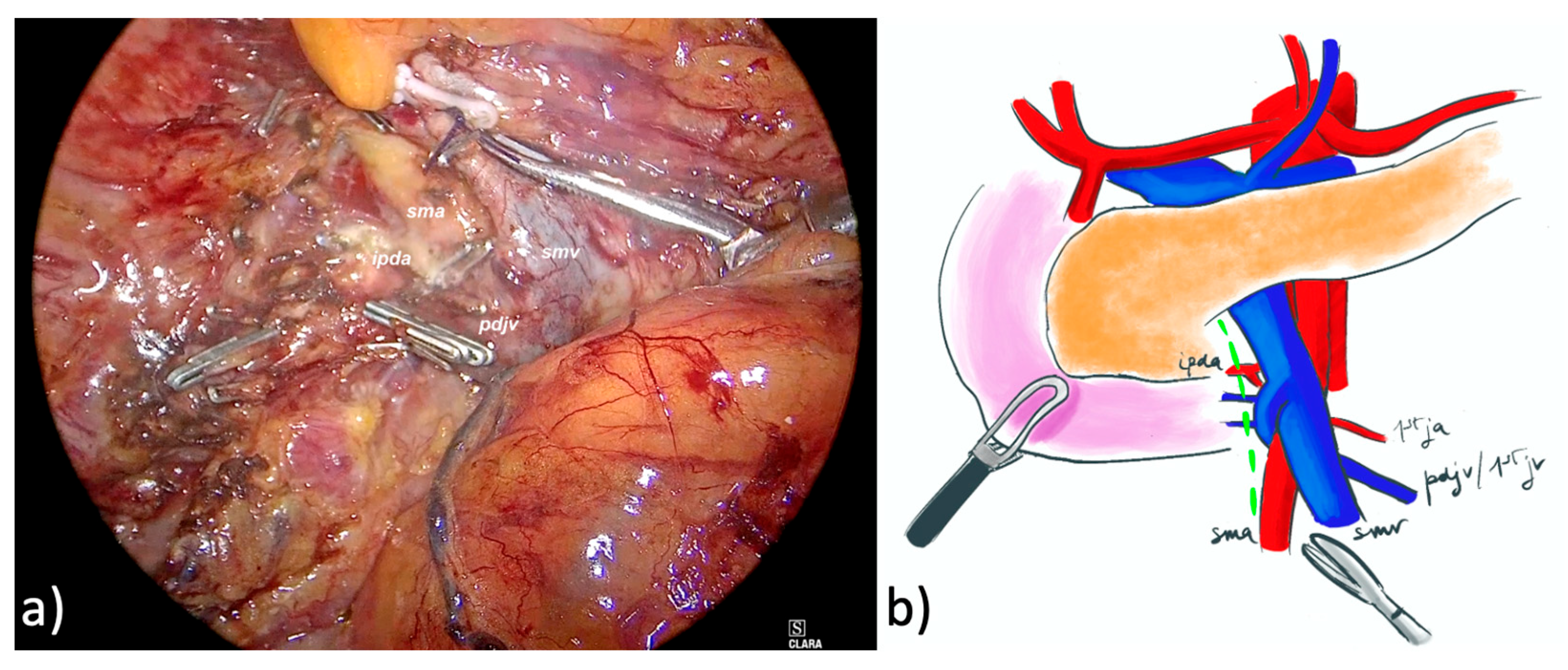 Cancers 17 02103 g001