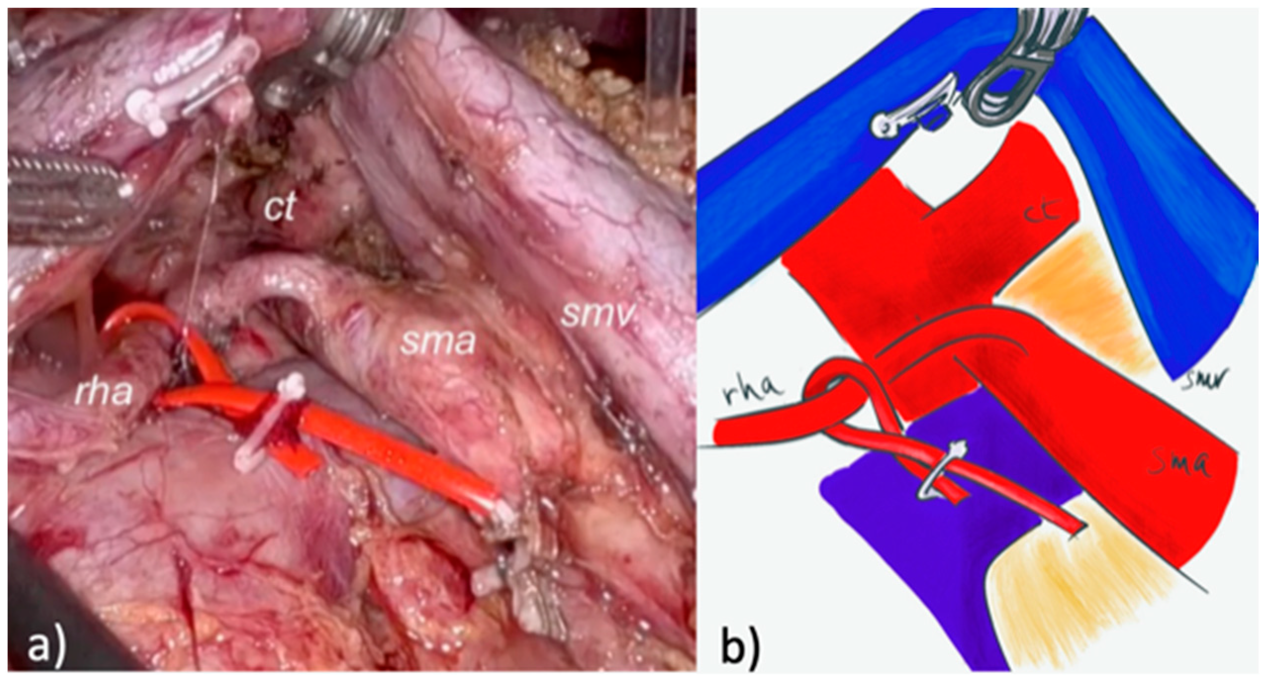 Cancers 17 02103 g003
